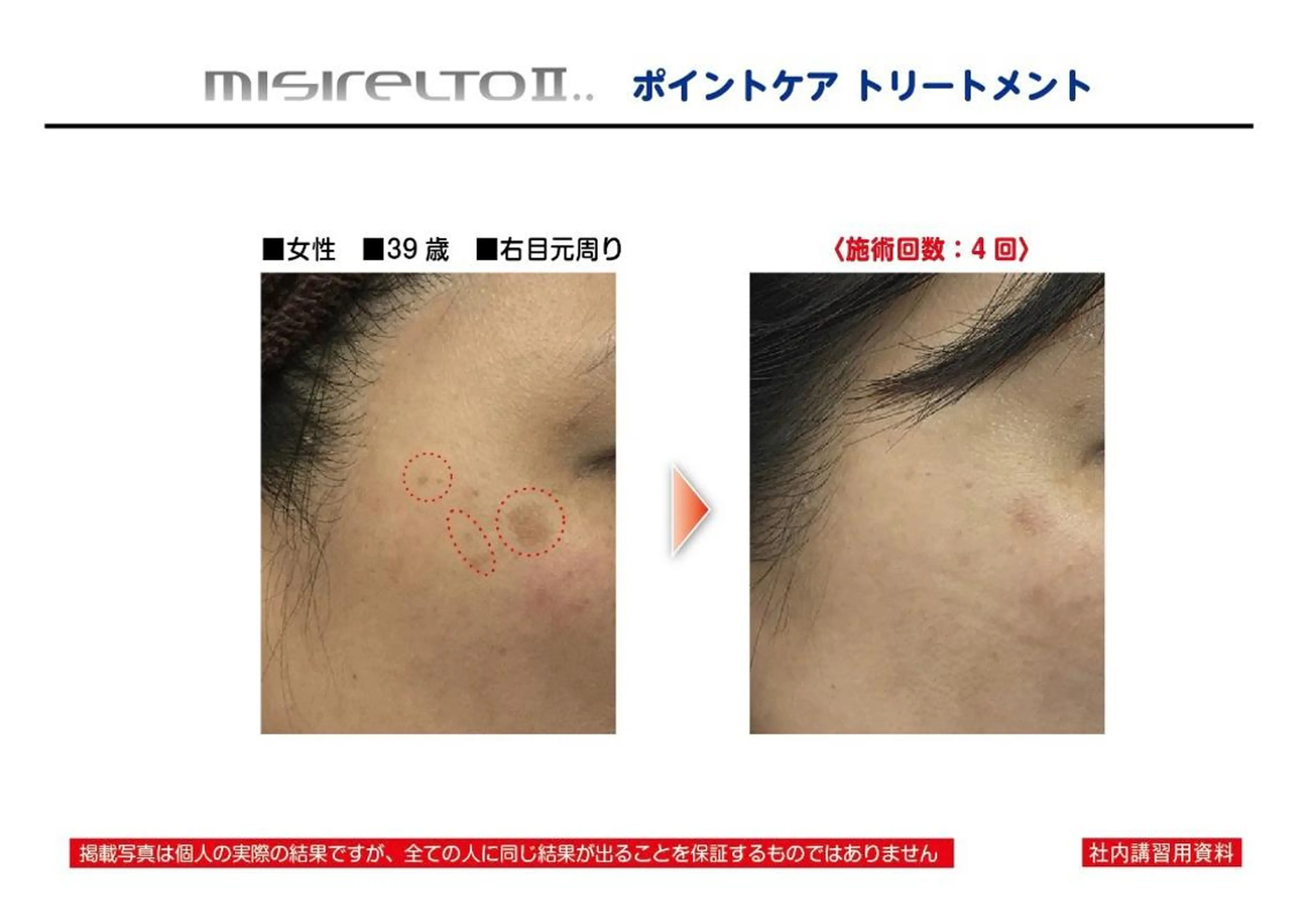 エステ ANGEL NAIL所属・RE:BORN 大阪四條畷市のエステ・リラクイメージ