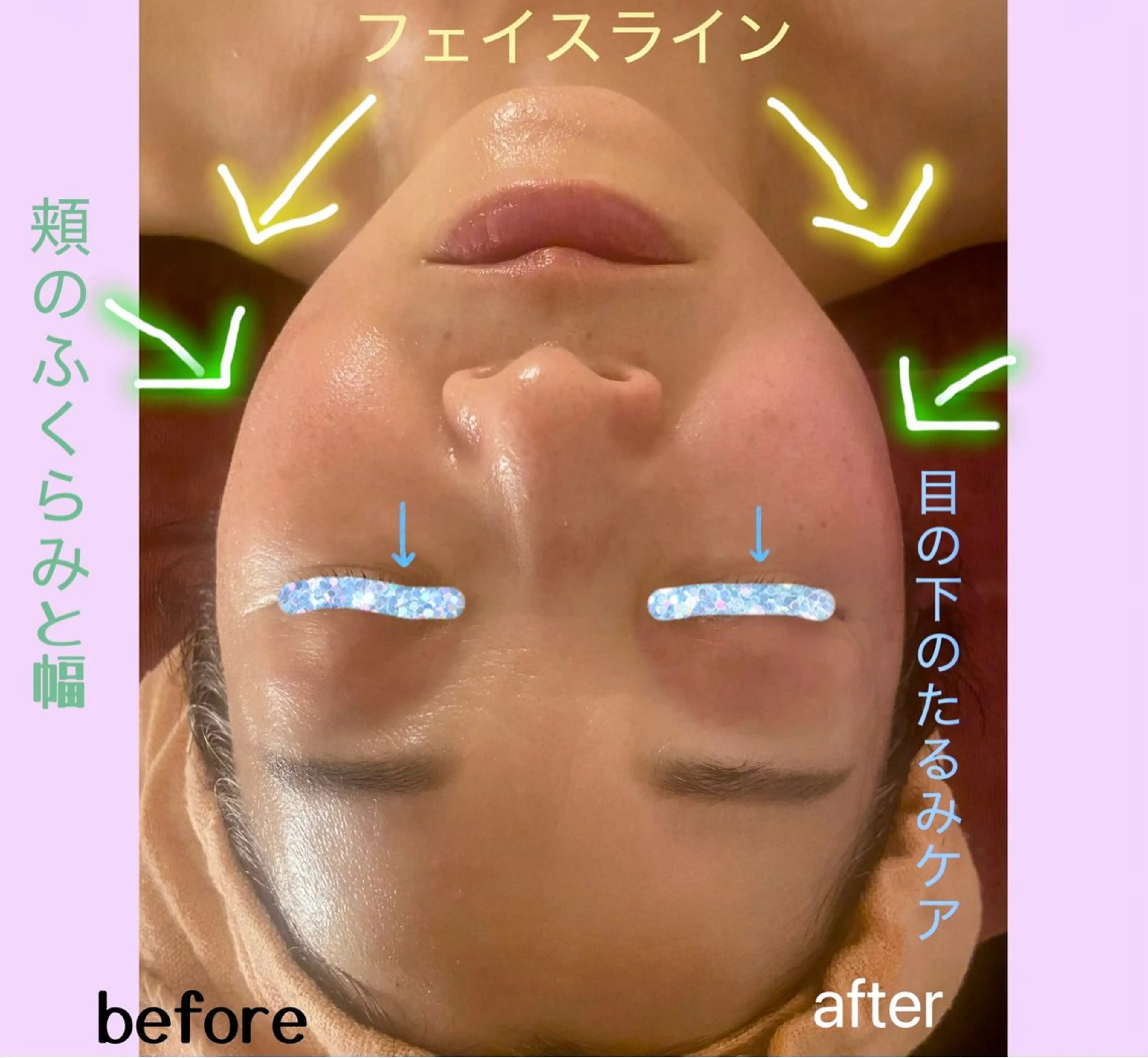 たるみサヨナラ宣言フェイシャルの写真