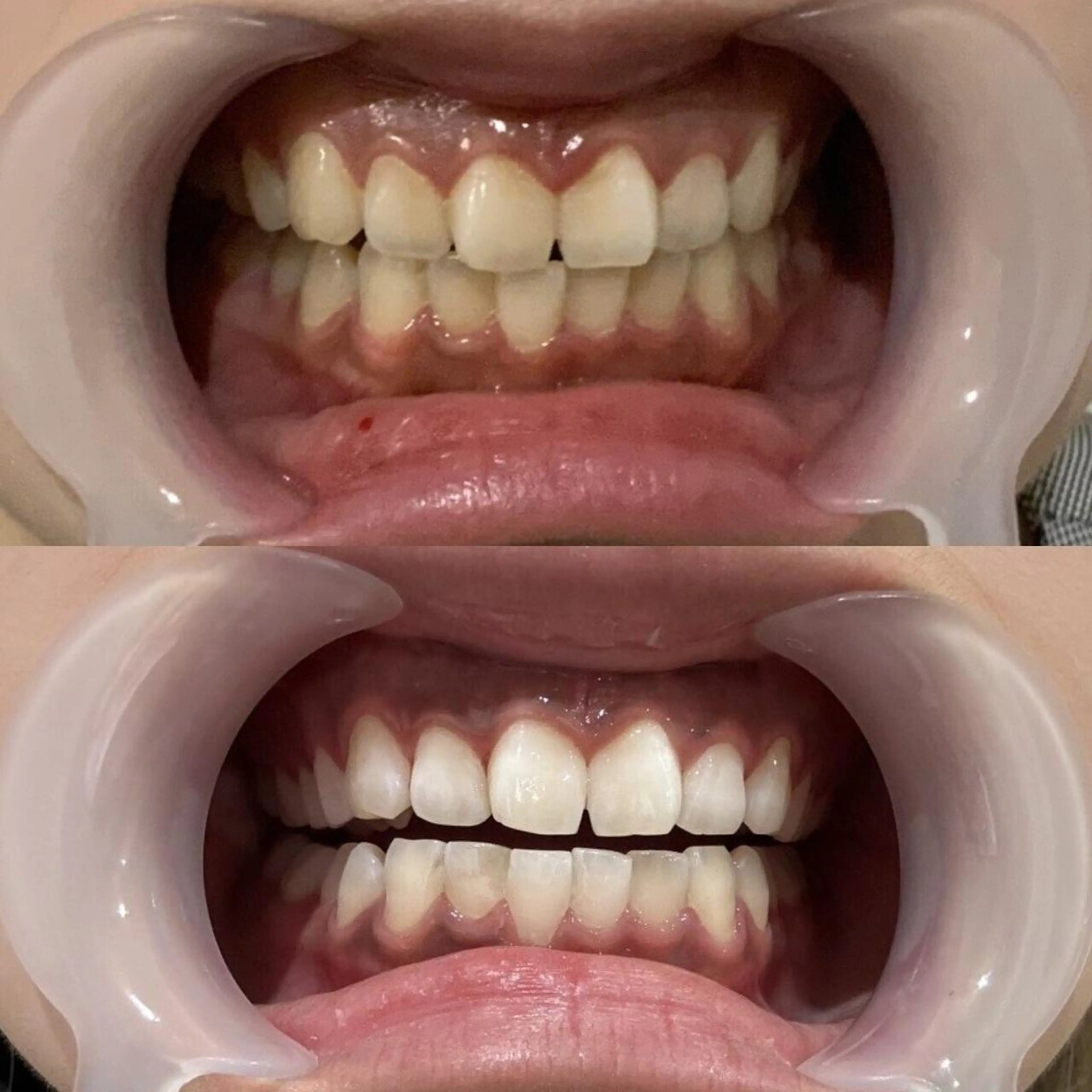 SELFMADE 石巻店のエステ・リラクイメージ