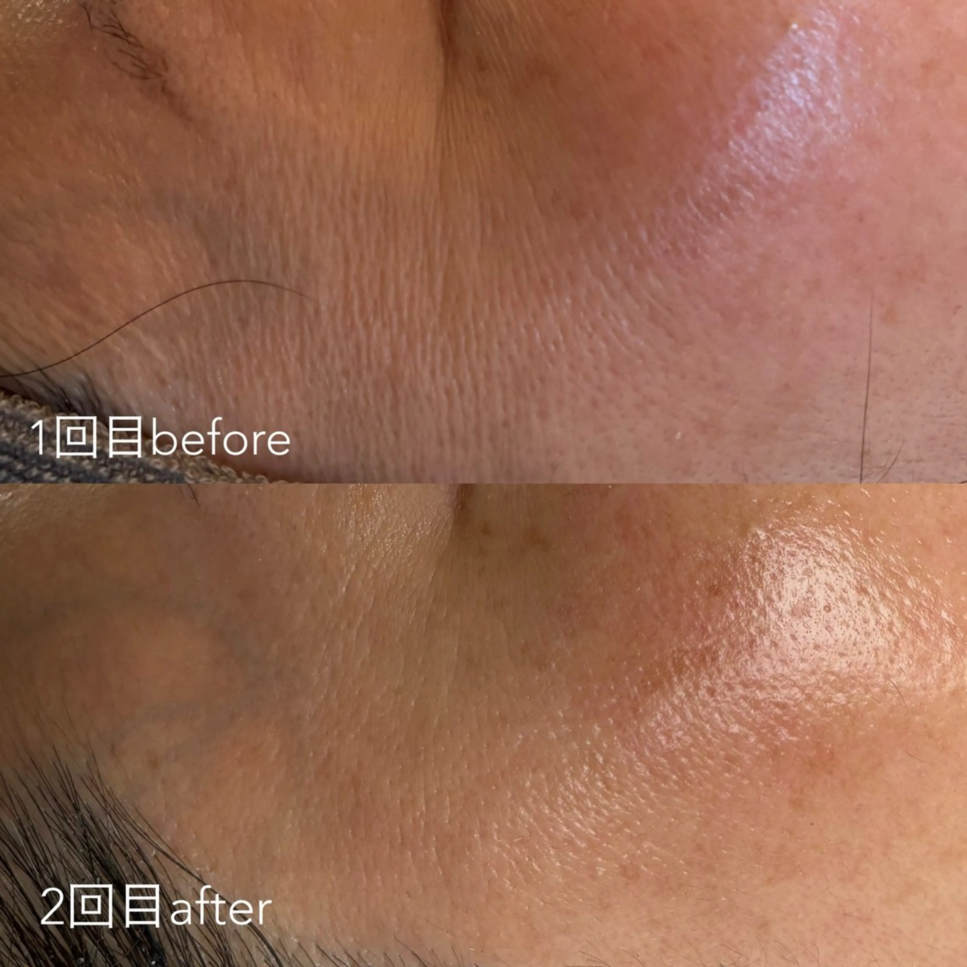 エステティックサロン Liente(リアンテ）所属・Hashimoto .のエステ・リラクイメージ