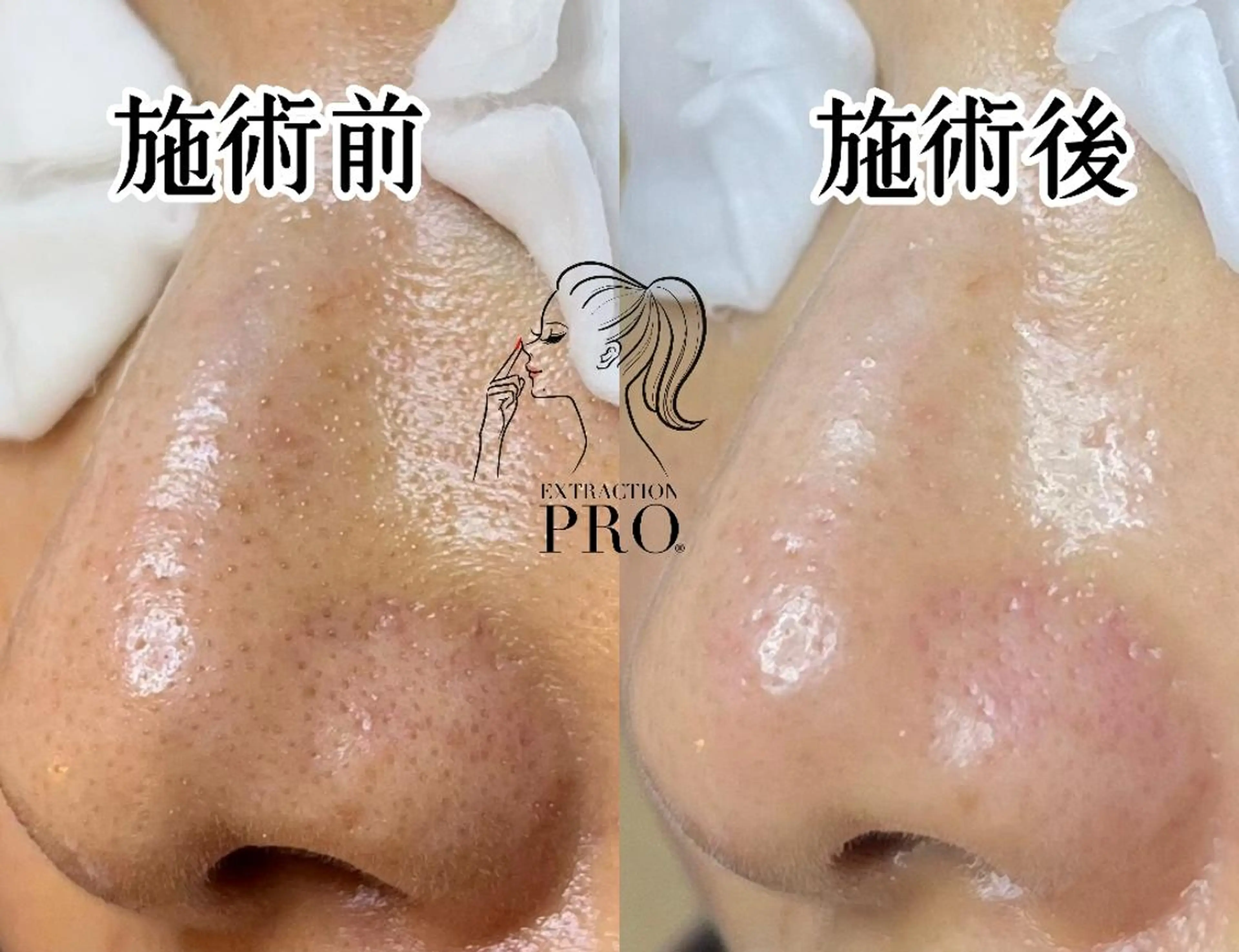 エステ Lipula リプラ所属・毛穴ツヤ肌専門    Lipulaのエステ・リラクイメージ