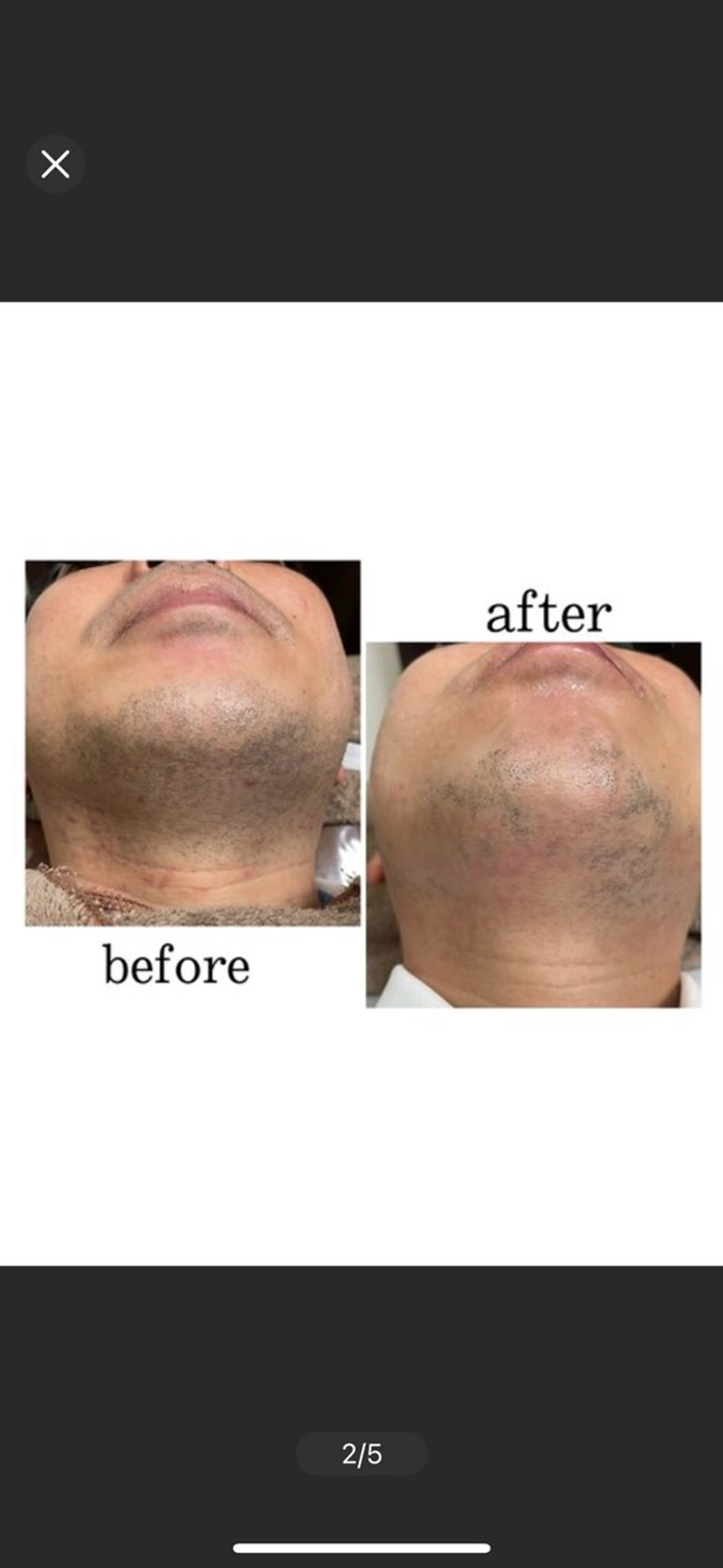 メンズ 【folche】 フジイのエステ・リラクイメージ