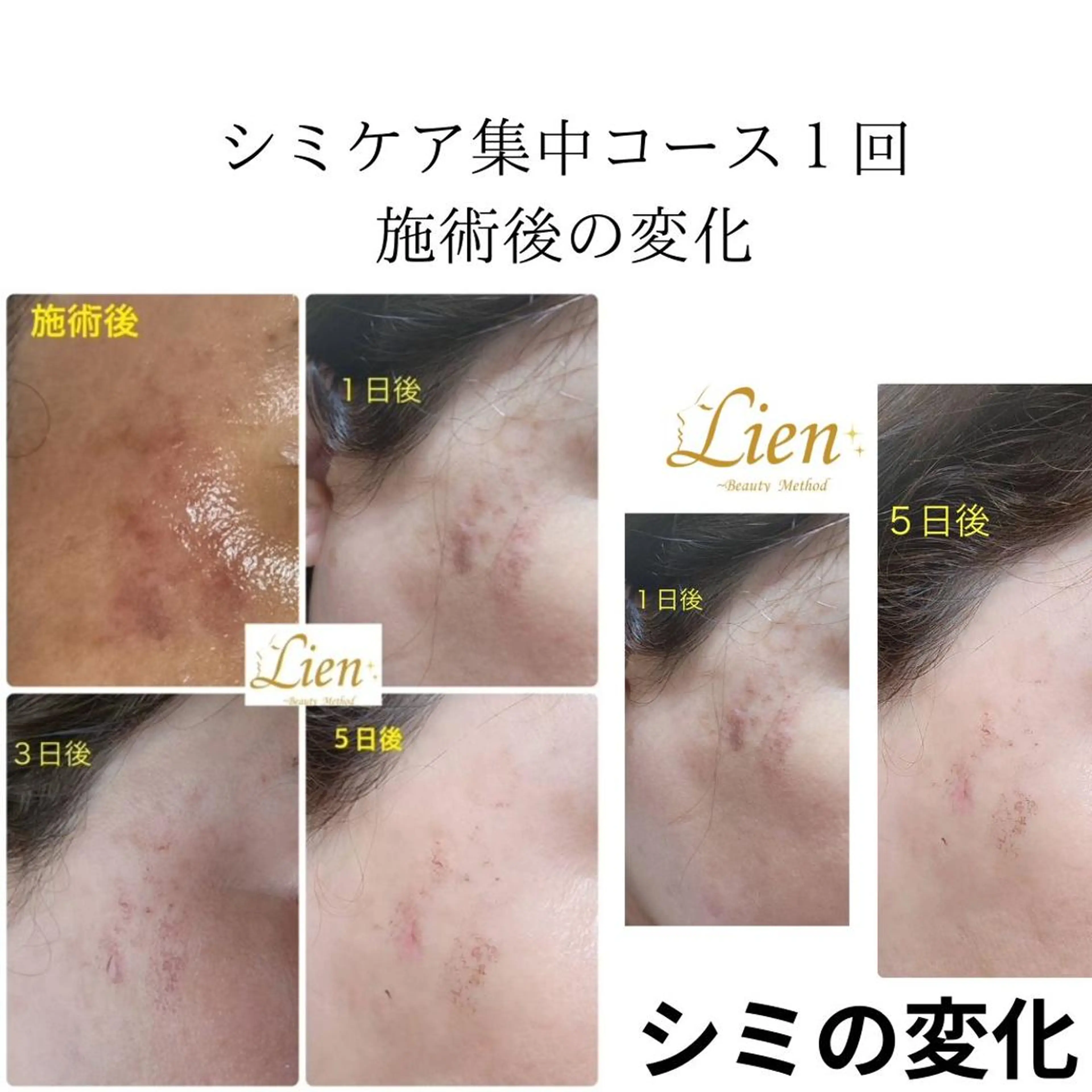 Lien オーナー　山口智嘉のエステ・リラクイメージ