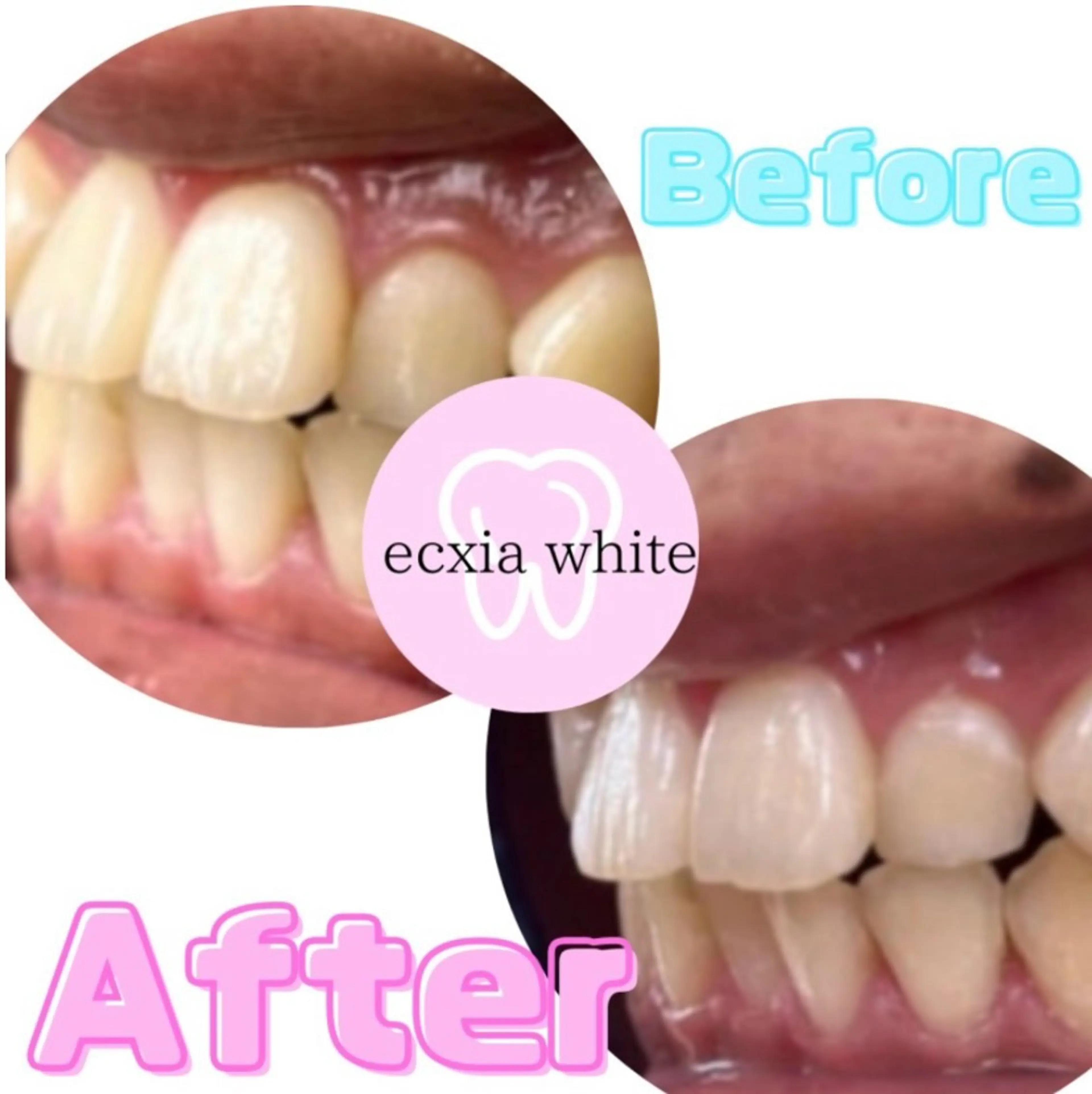 エクシアホワイトニング前橋店所属・セルフホワイトニング エクシア前橋店のその他イメージ