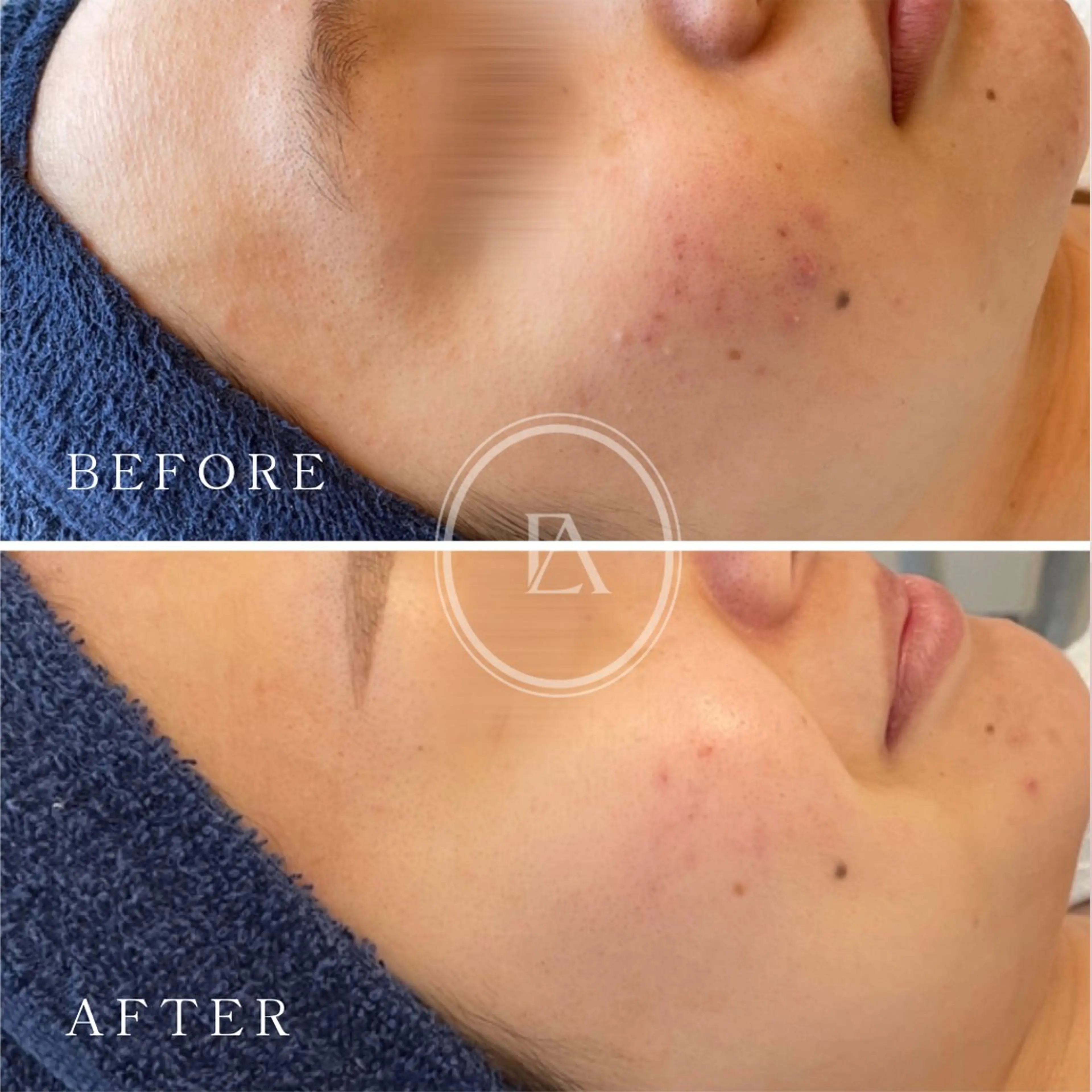 エステ エストリア 所沢店のエステ・リラクイメージ