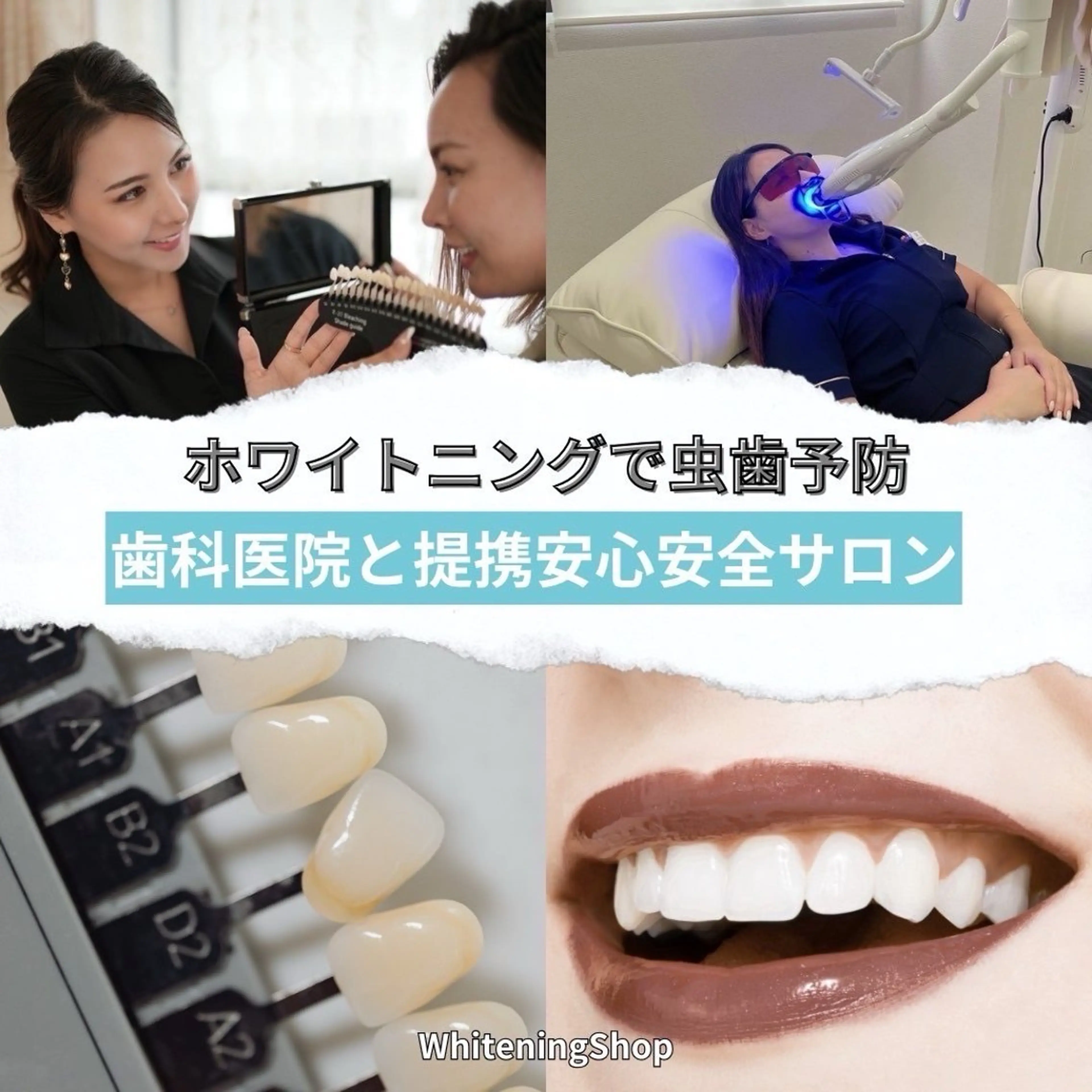 ホワイトニングショップ　四条店所属・ホワイトニング ショップ 四条店のエステ・リラクイメージ