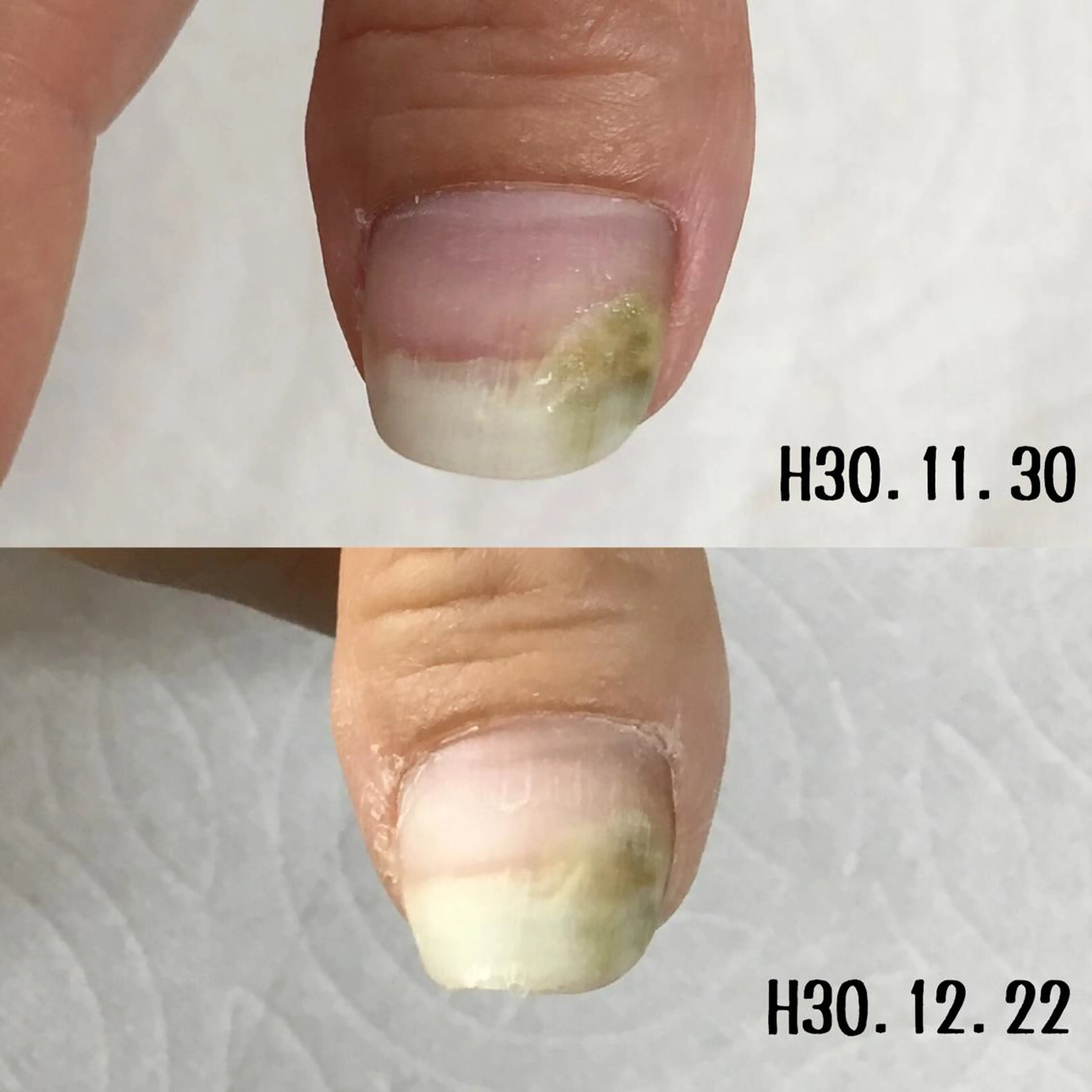 ネイル グリーン その他(ネイル) BELTA NAILのネイルデザイン