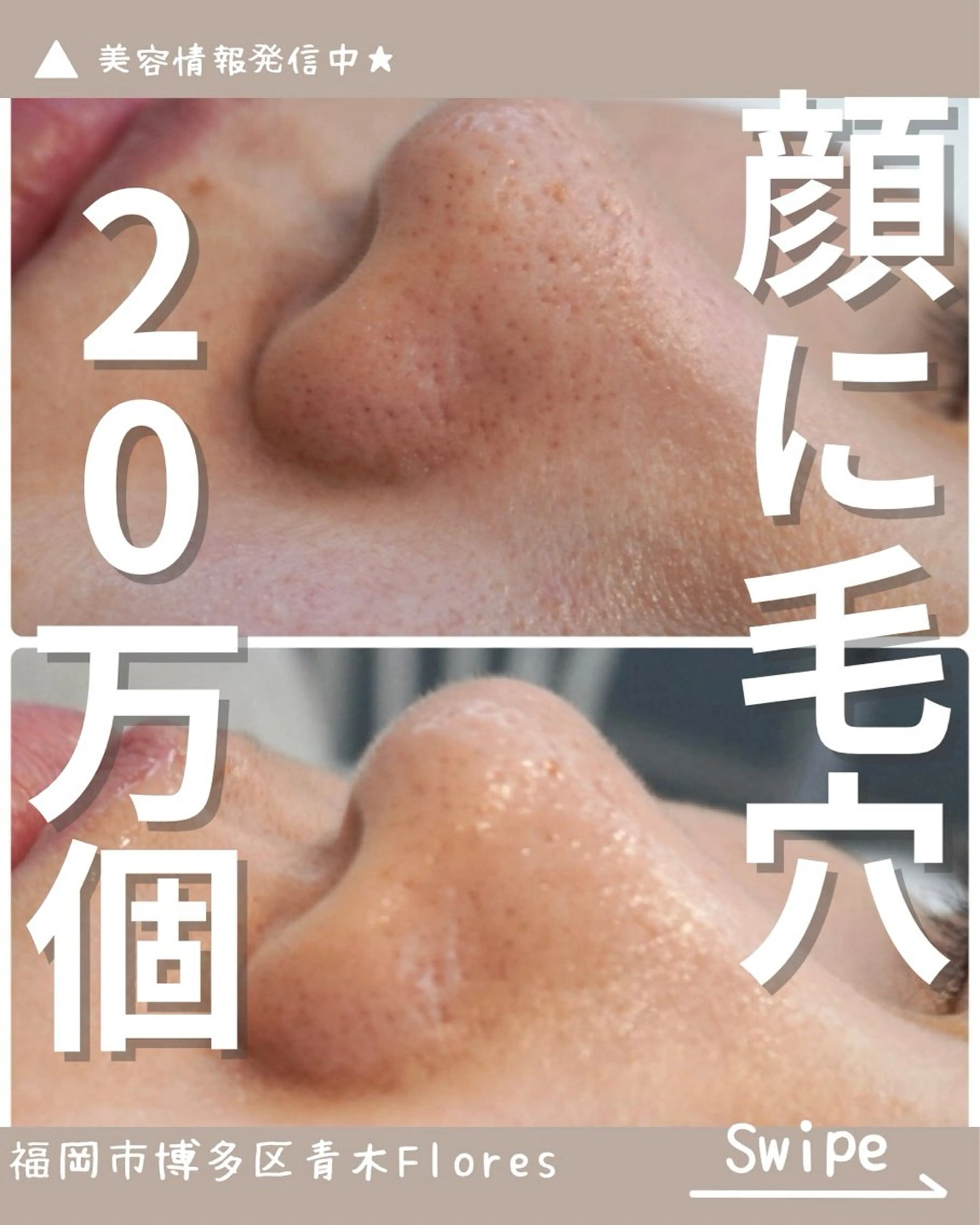 ミニモ学割✨🍓いちご鼻集中ケア🍓30分のクイックケア✨気になる黒ずみを徹底ケア✨の写真