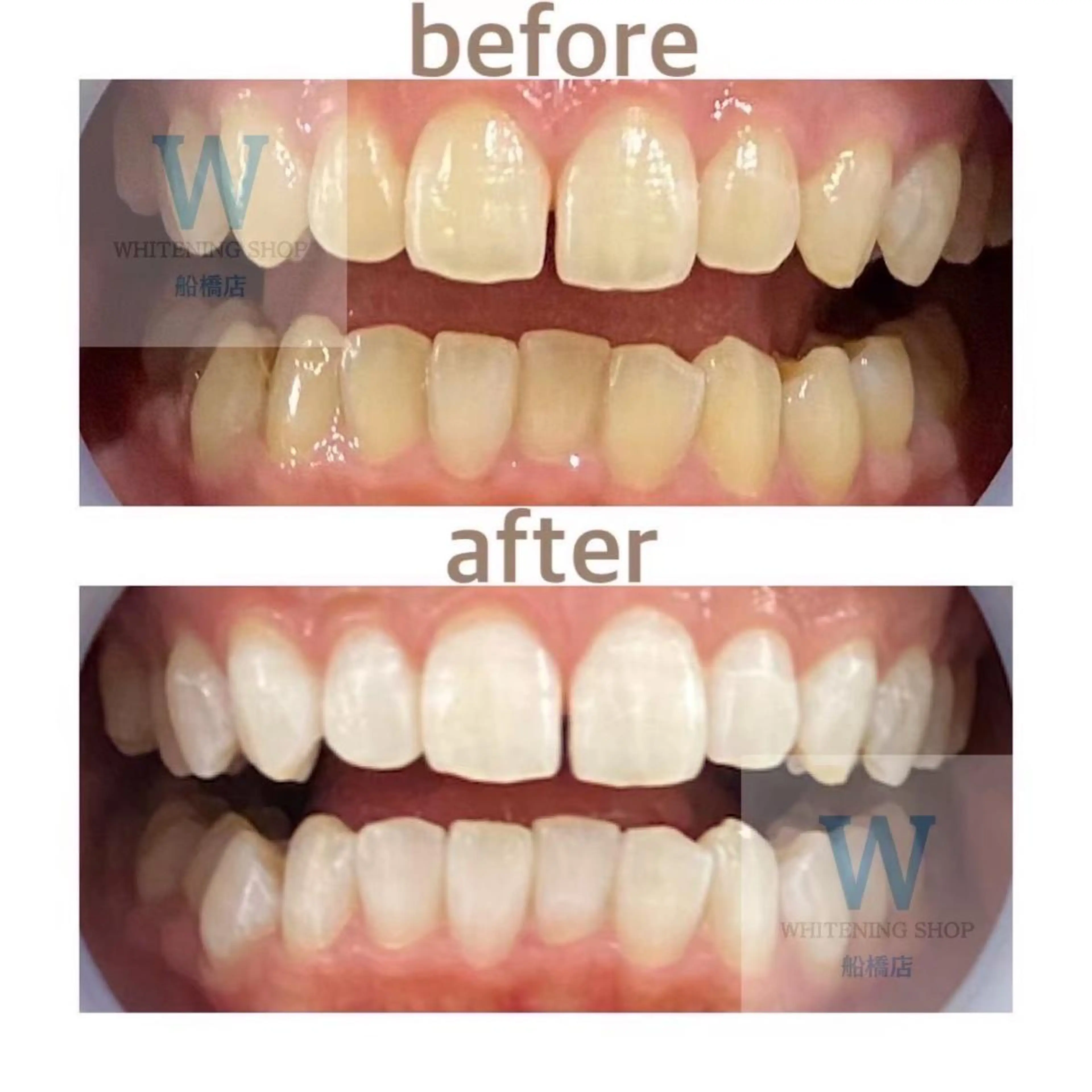 エステ リラク ホワイトニング ショップ船橋店🦷のエステ・リラクイメージ