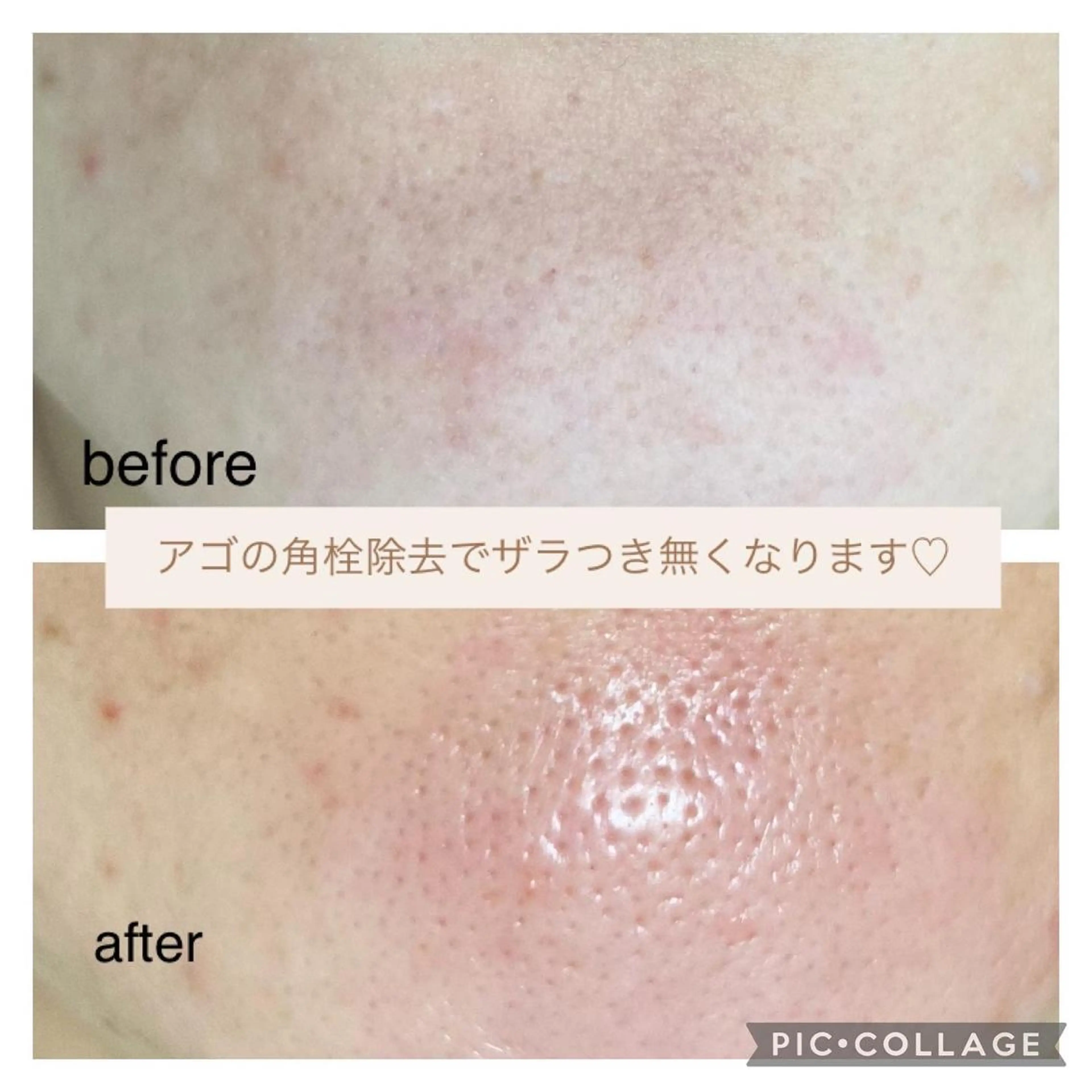 エステ 毛穴ケア・肌質改善 徳川のエステ・リラクイメージ