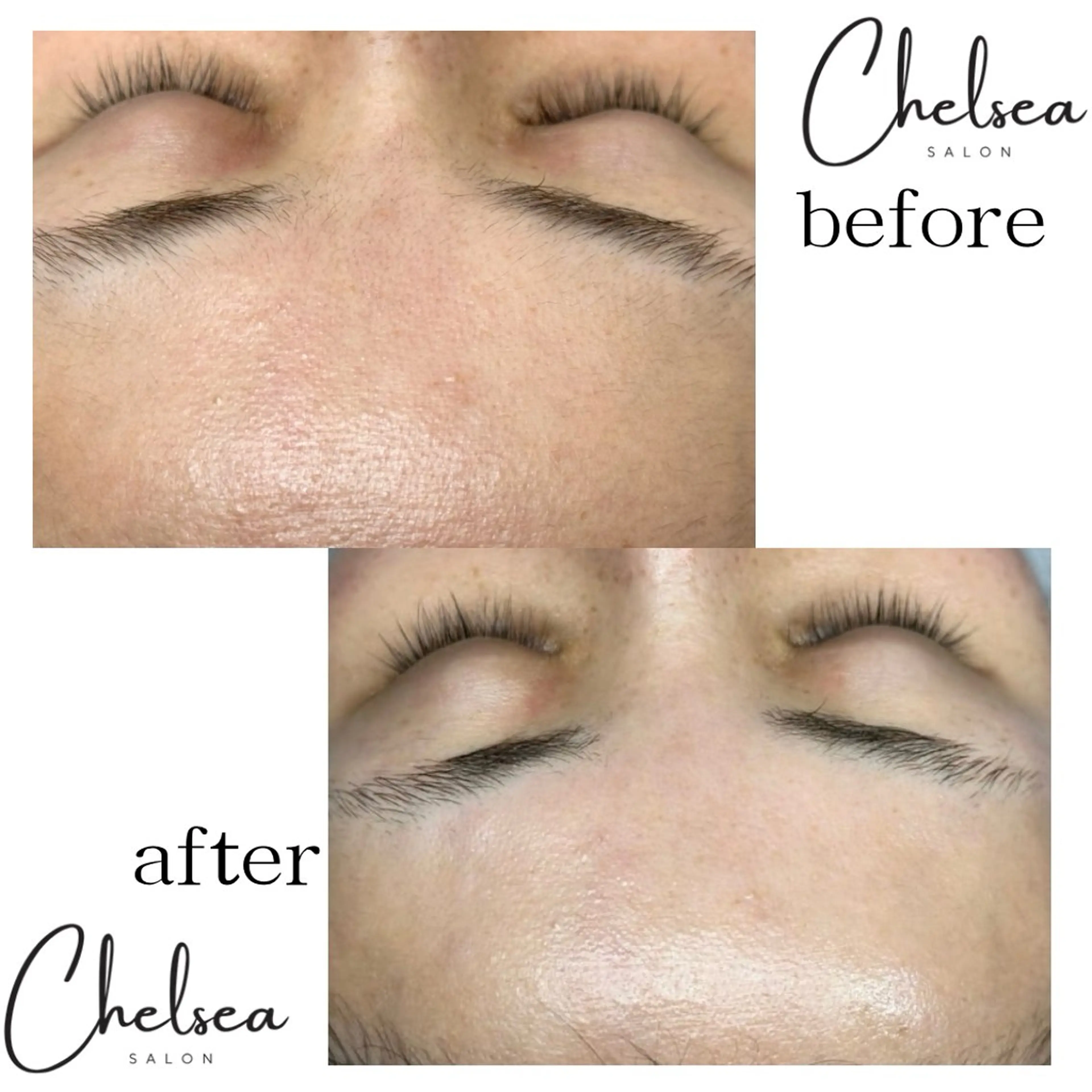 Chelsea所属・Chelsea 政　千尋のエステ・リラクイメージ