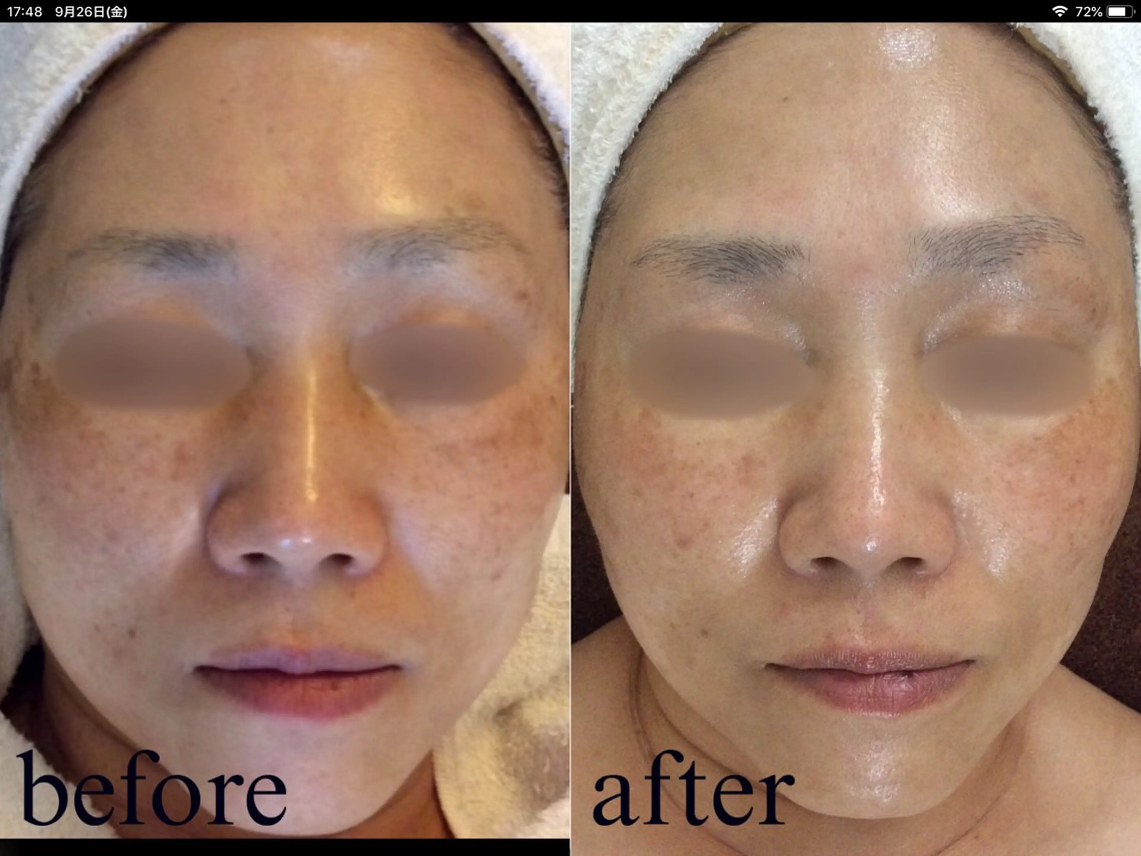 エステ Salon de Bis所属・サロン ド ビス 髙橋美月のエステ・リラクイメージ