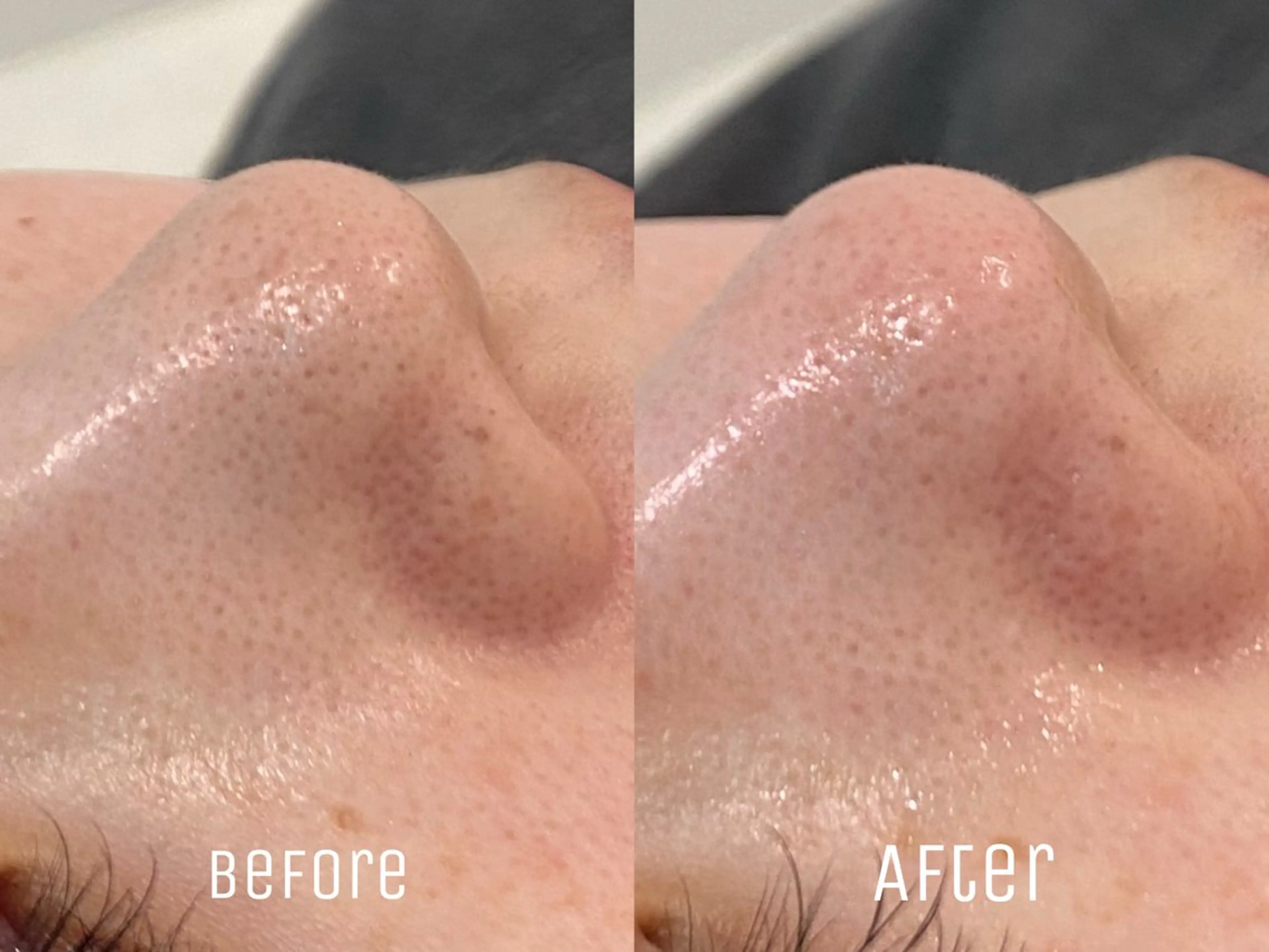 エステ ニキビ・毛穴・肌荒れ &me 西宮北口店のその他イメージ