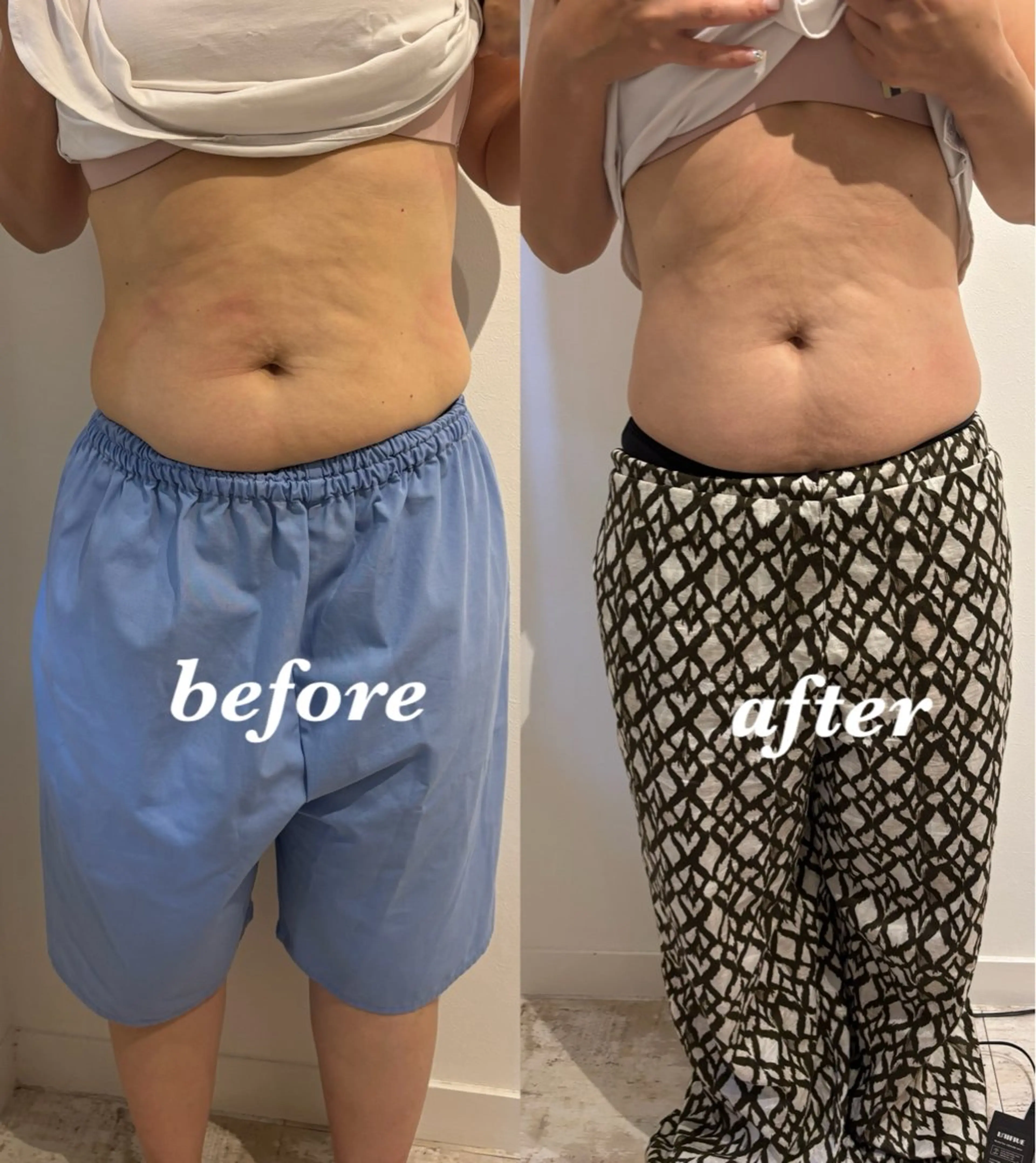 エステ リラク 腸活サポート みなみののエステ・リラクイメージ