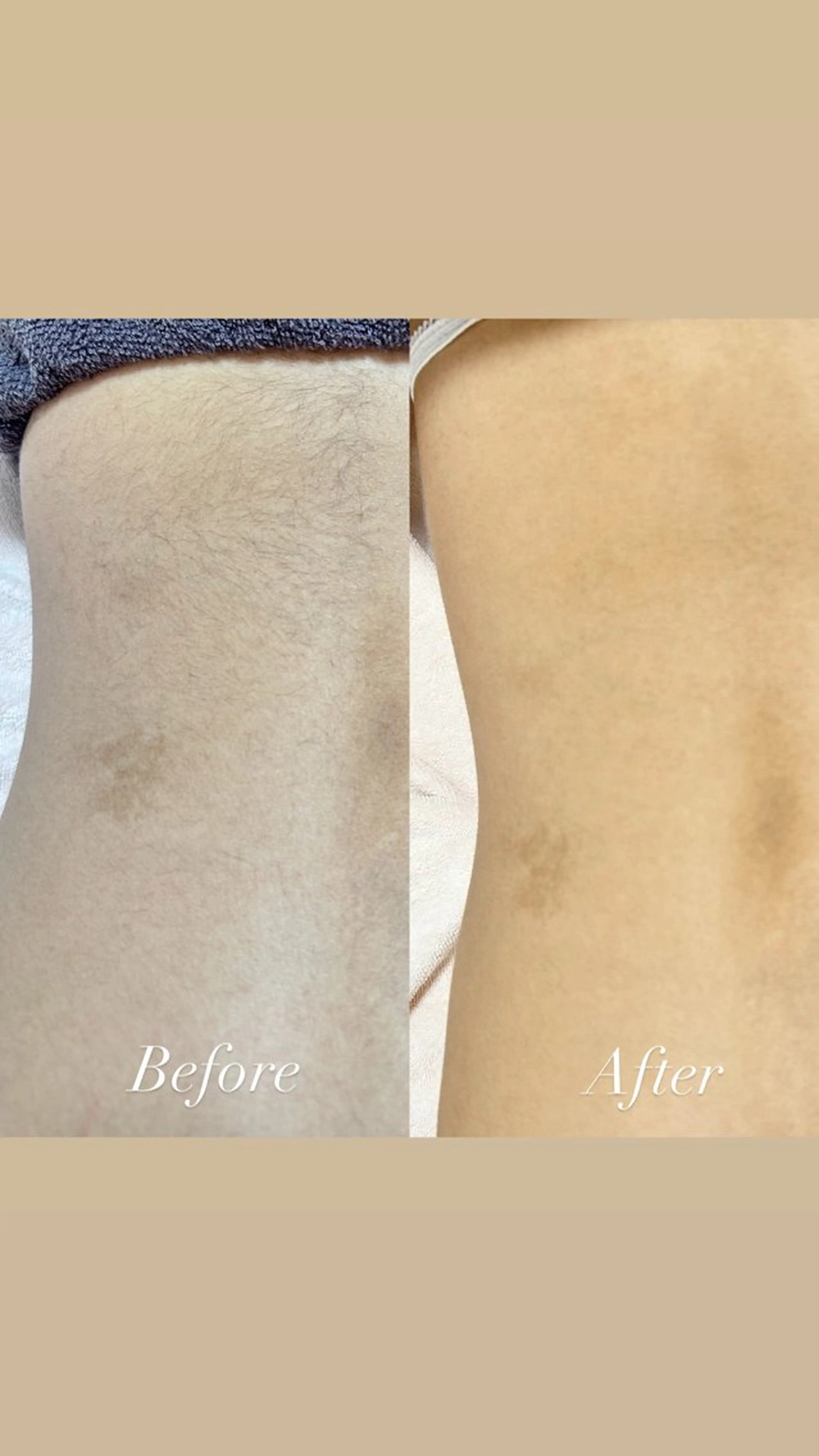 都度払い制脱毛サロンBe Charm所属・Be Charm 山﨑のエステ・リラクイメージ