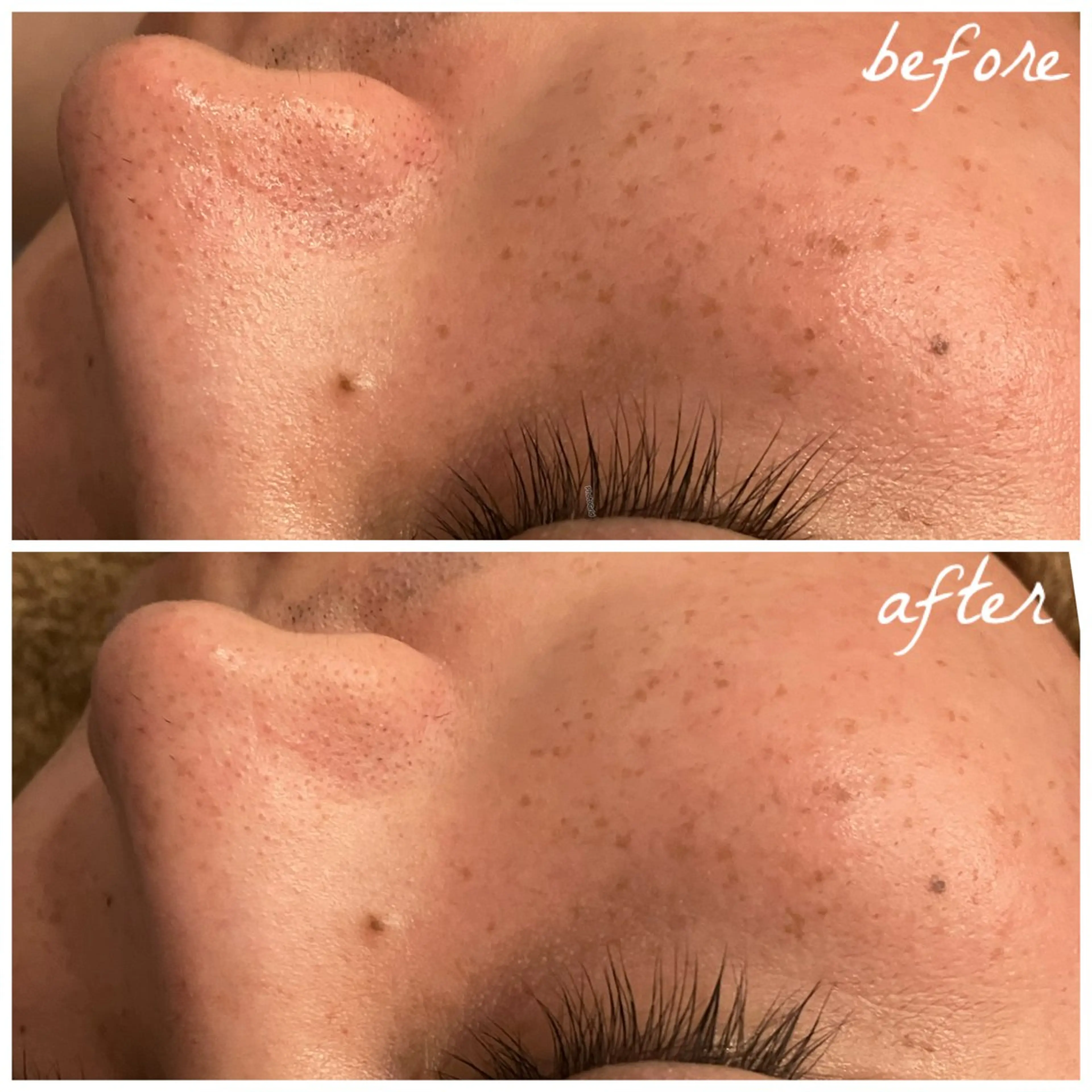 メンズ メナード岐阜茜部 杉浦のエステ・リラクイメージ