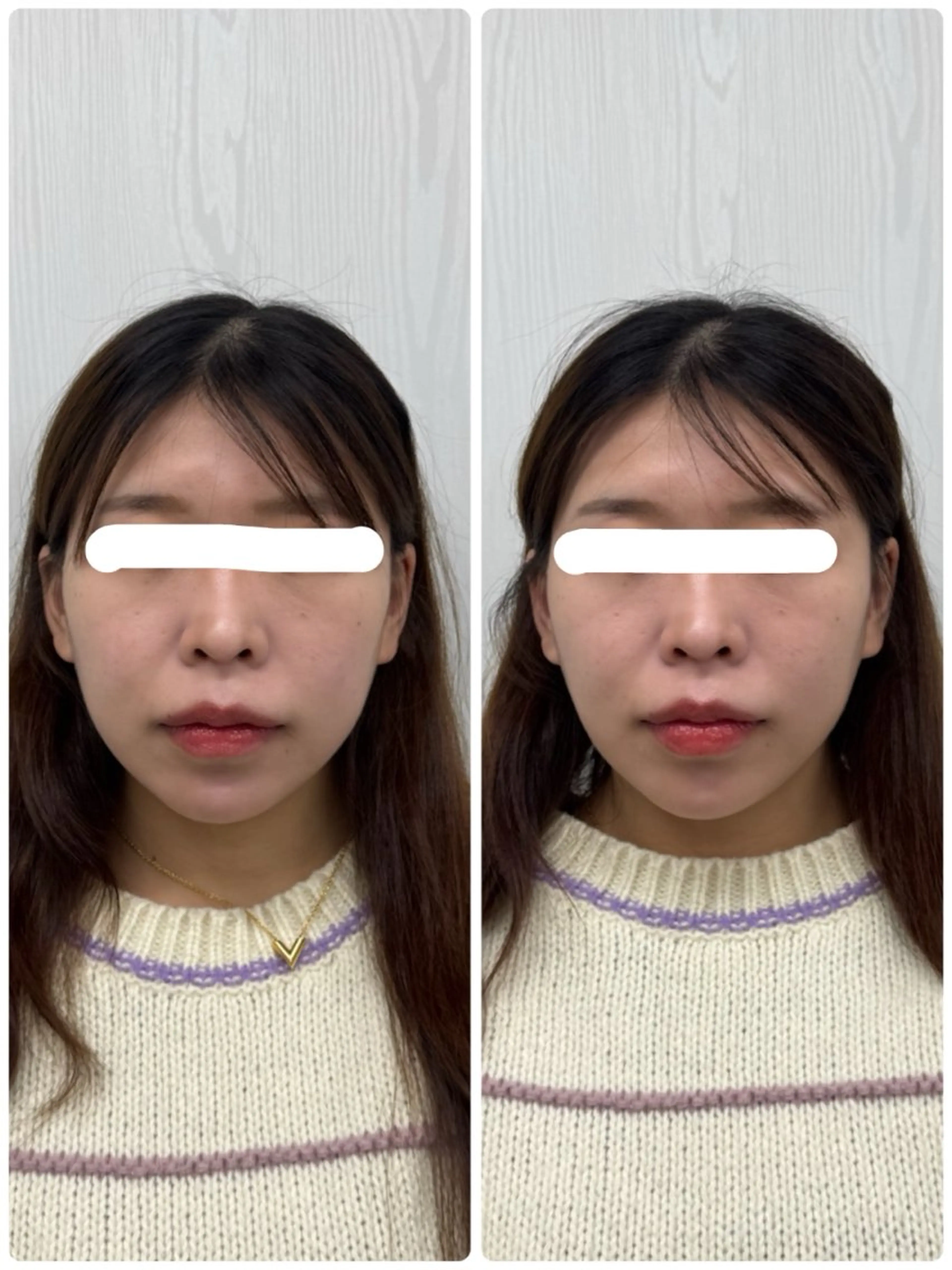 エステ リラク 美容鍼×小顔矯正 ×美容整体　浜川泰仁のエステ・リラクイメージ