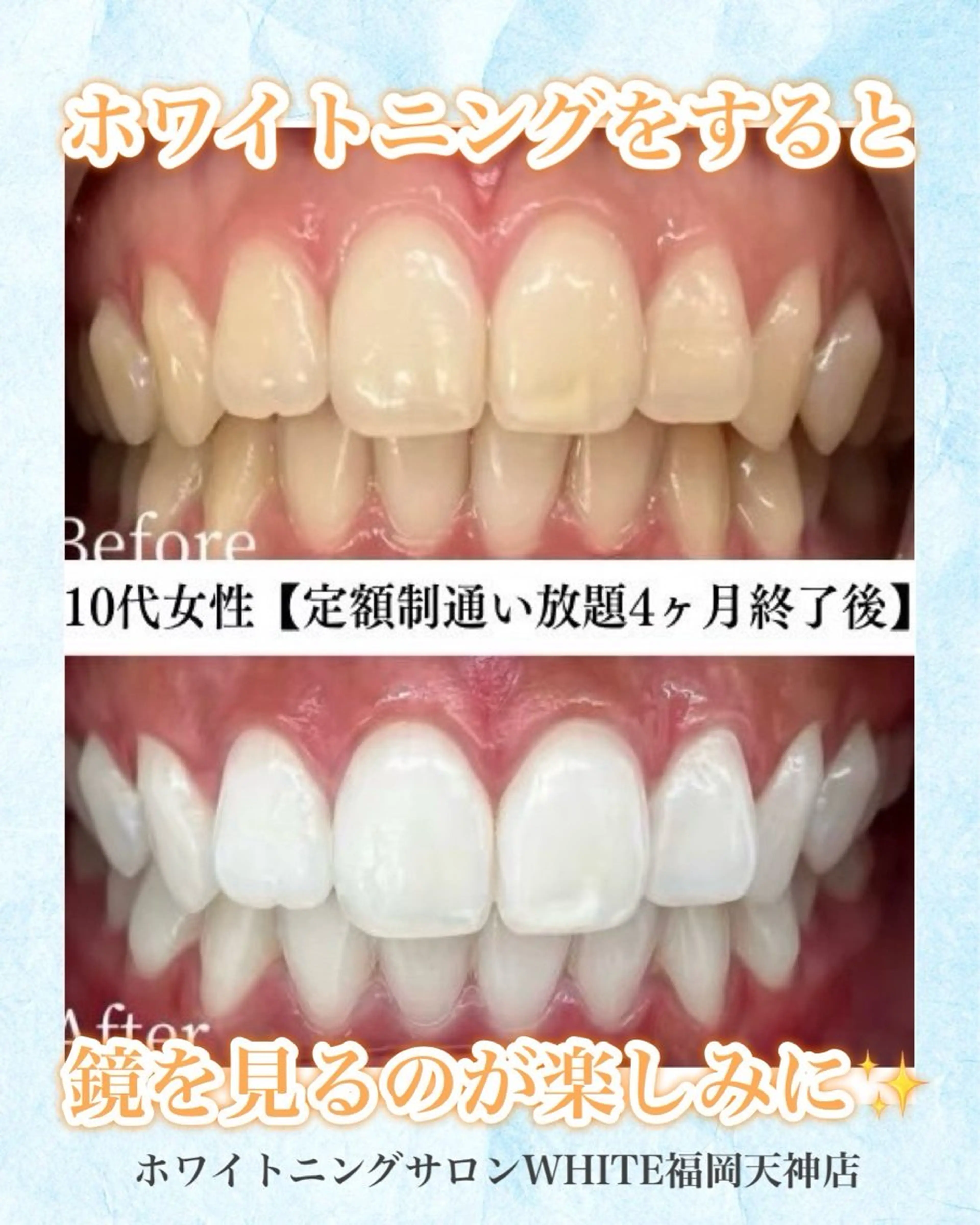 メンズ エステ リラク ホワイトニング専門店 WHITE天神店のエステ・リラクイメージ