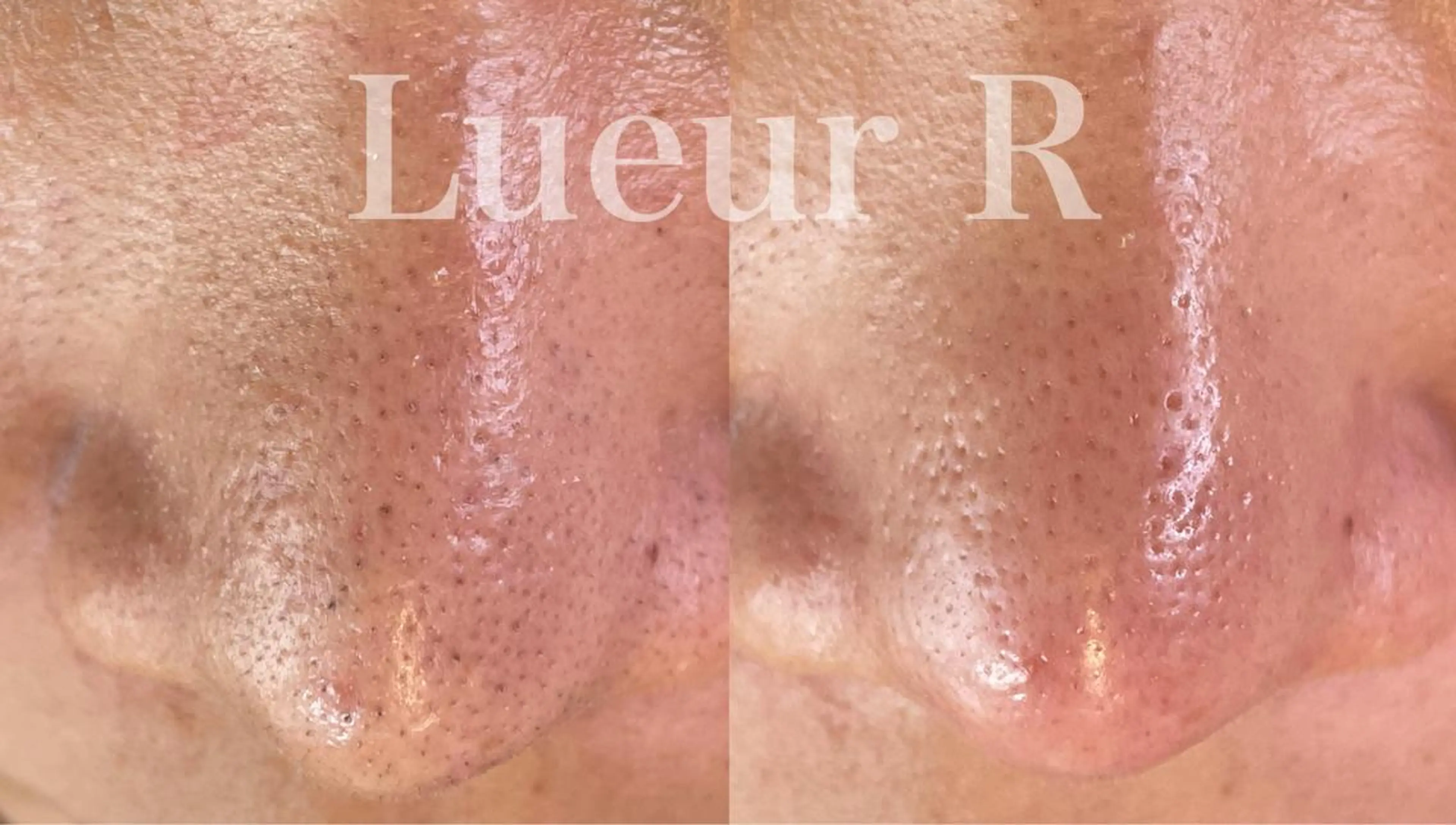 エステ 大久保 里奈のエステ・リラクイメージ