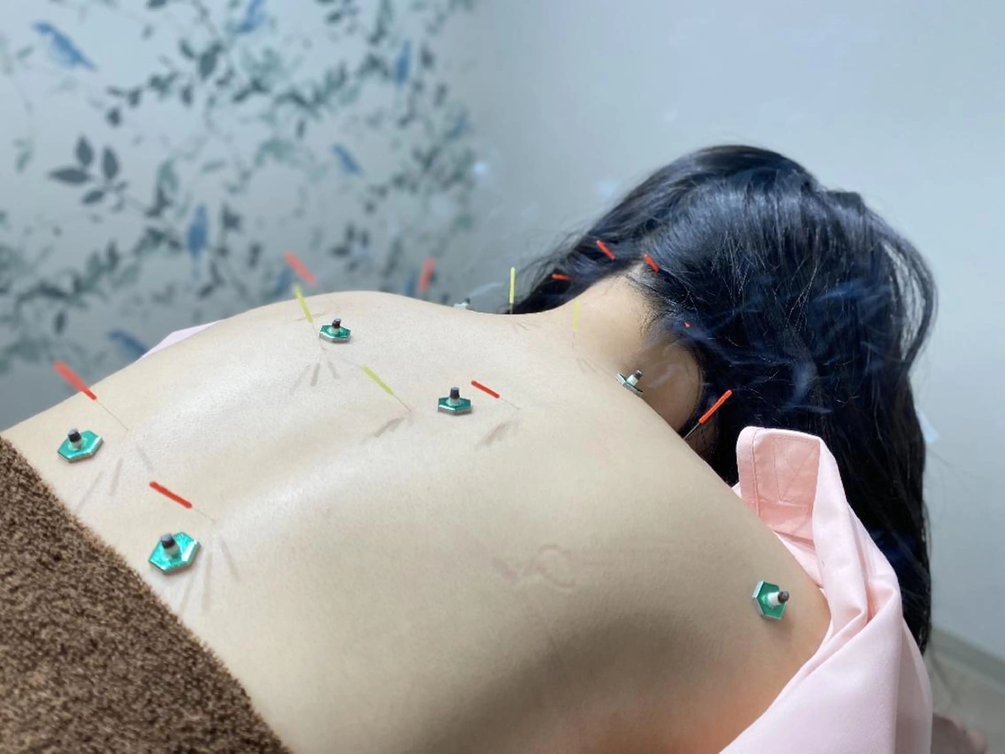 ❤リピーター割❤首肩コリや腰痛に『ボディケア鍼灸施術』の写真