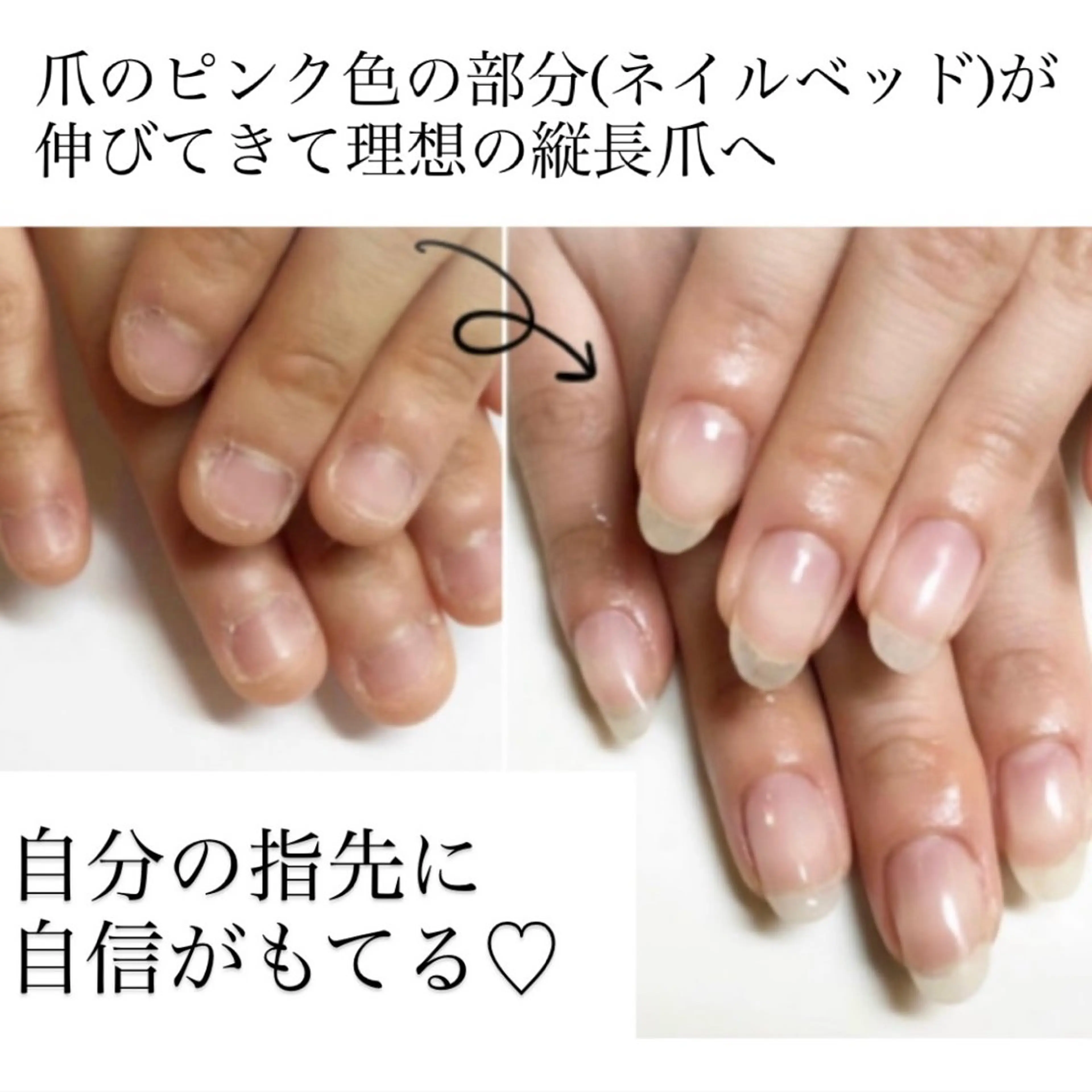 メンズ ネイル ハンドネイル ハンドケア 深爪矯正専門店　ネイルサロン　トイロ所属・ネイルサロン トイロのネイルデザイン