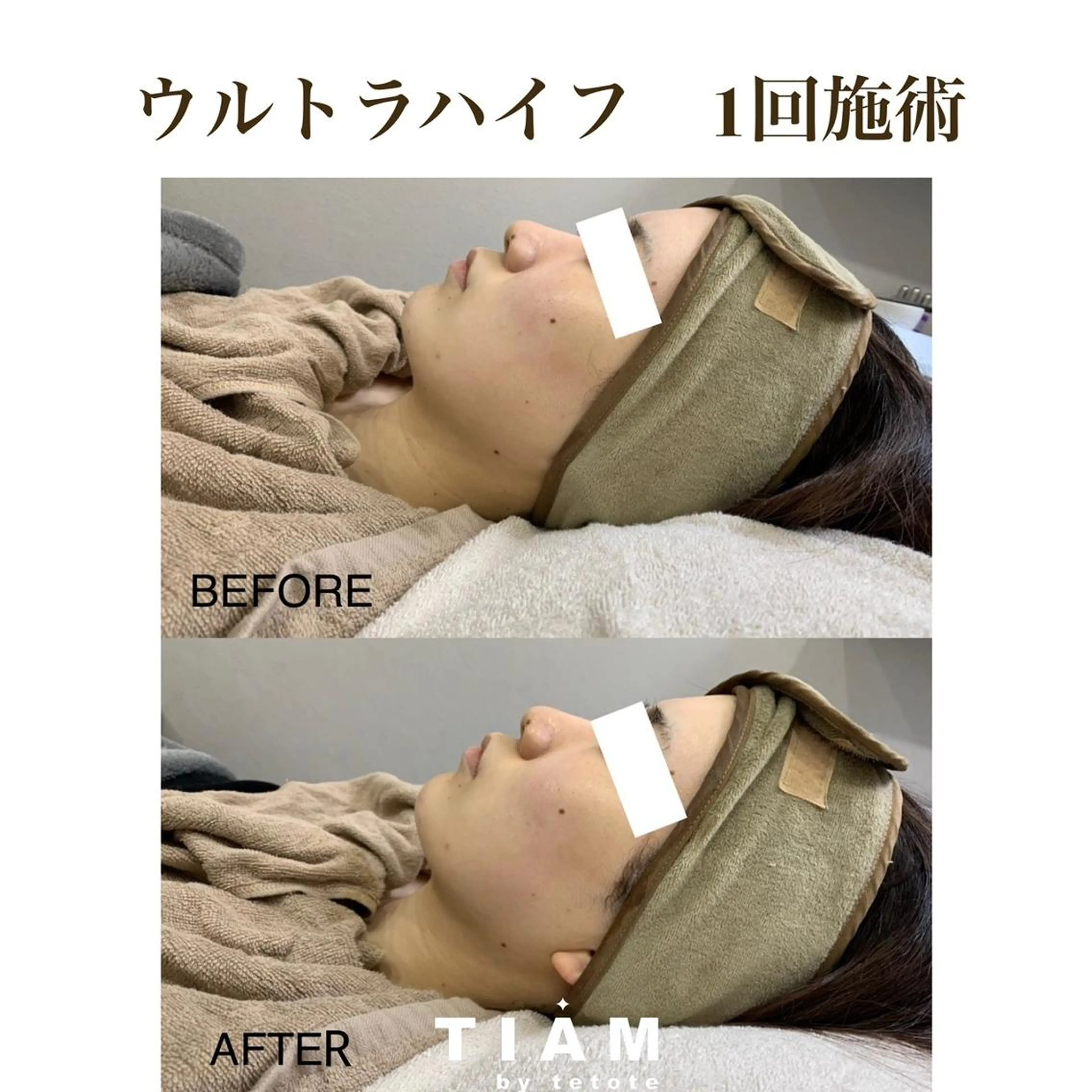 美肌サロンTIAM by tetoteのエステ・リラクイメージ