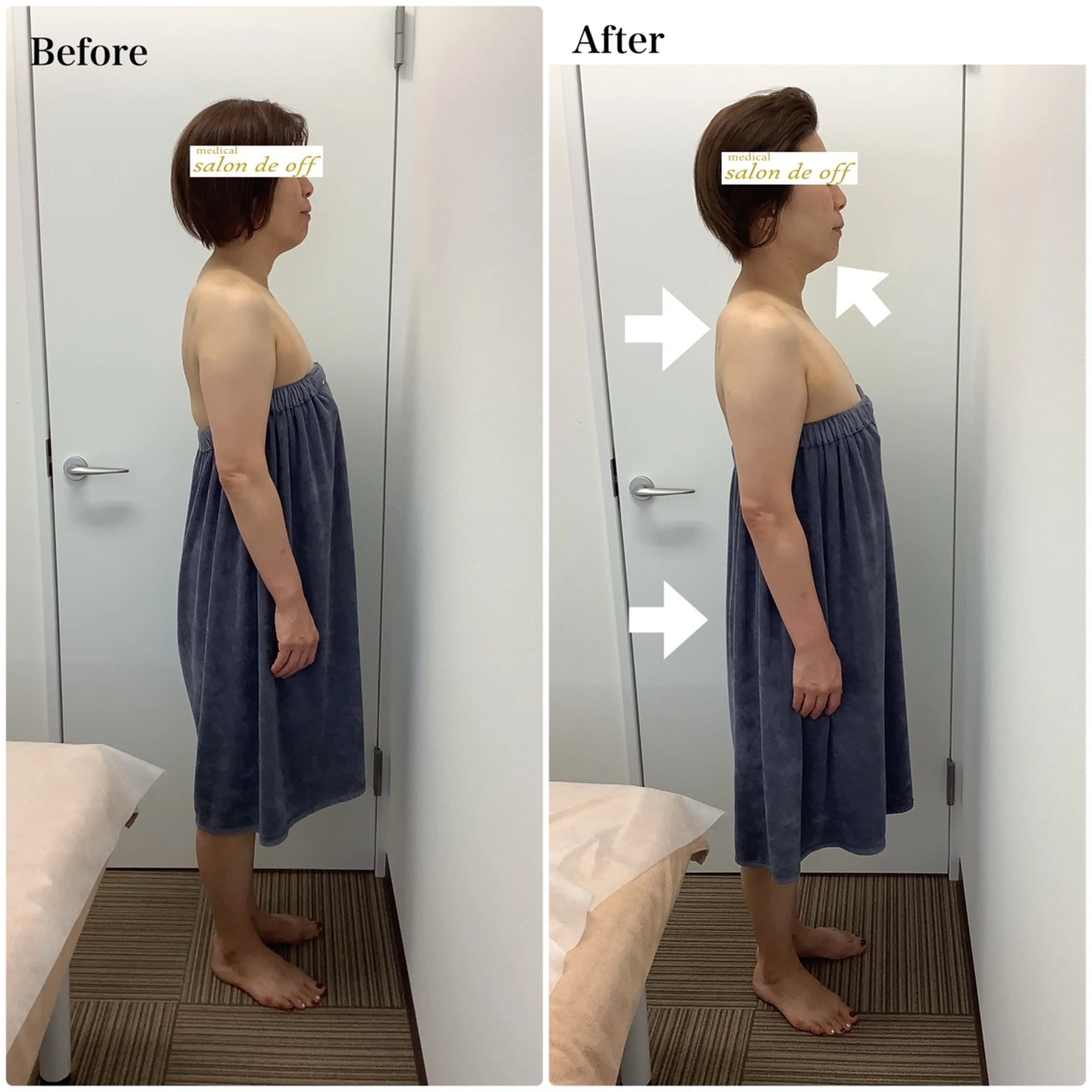 エステ リラク メディカルサロンドオフ所属・ハリサロンドオフ 美容鍼灸×小顔整体のエステ・リラクイメージ