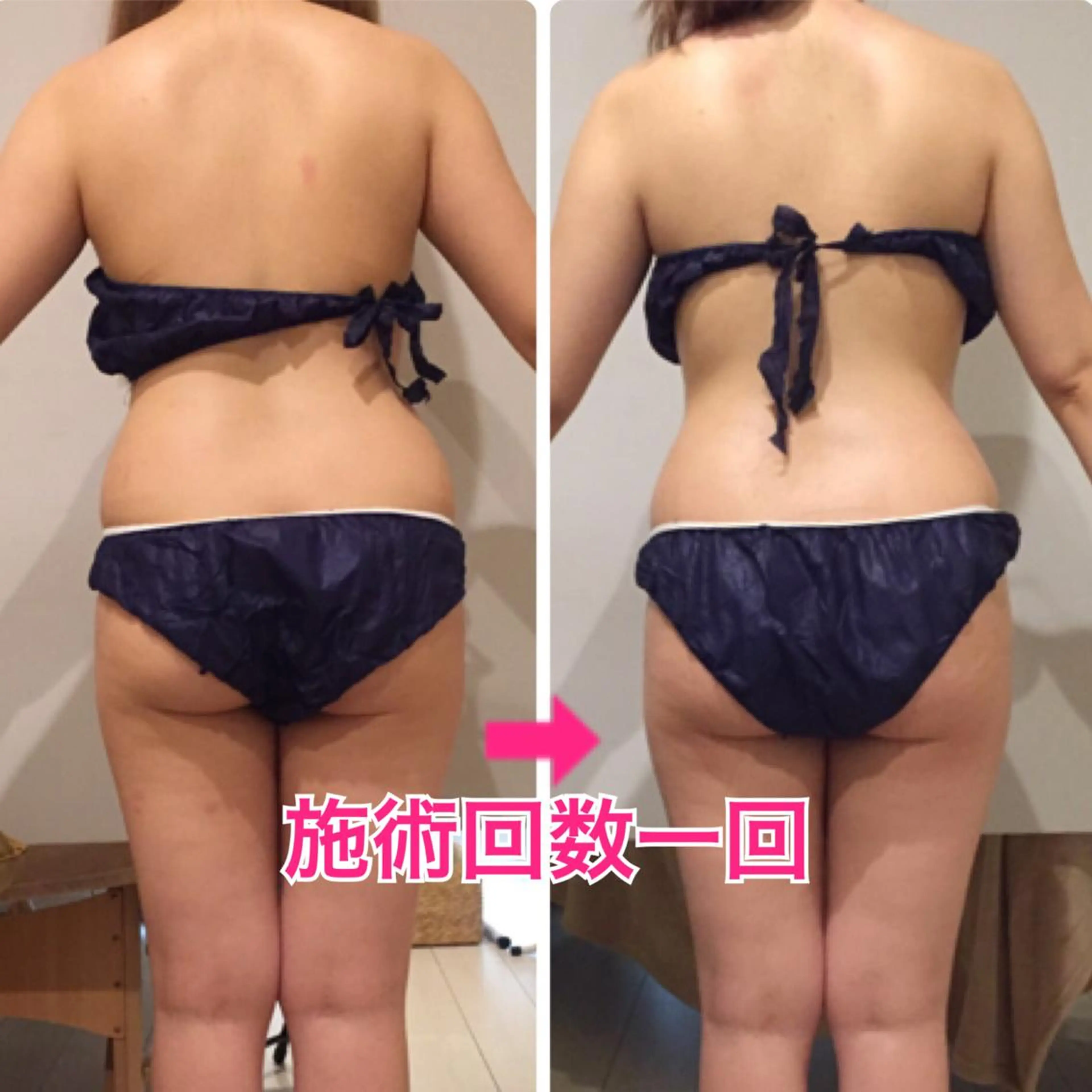 ショート カラー パーマ ヘアアレンジ メンズ キッズ ネイル マツエク・マツパ ‍痩身＆ボディ 結果出し🌟丹野のエステ・リラクイメージ