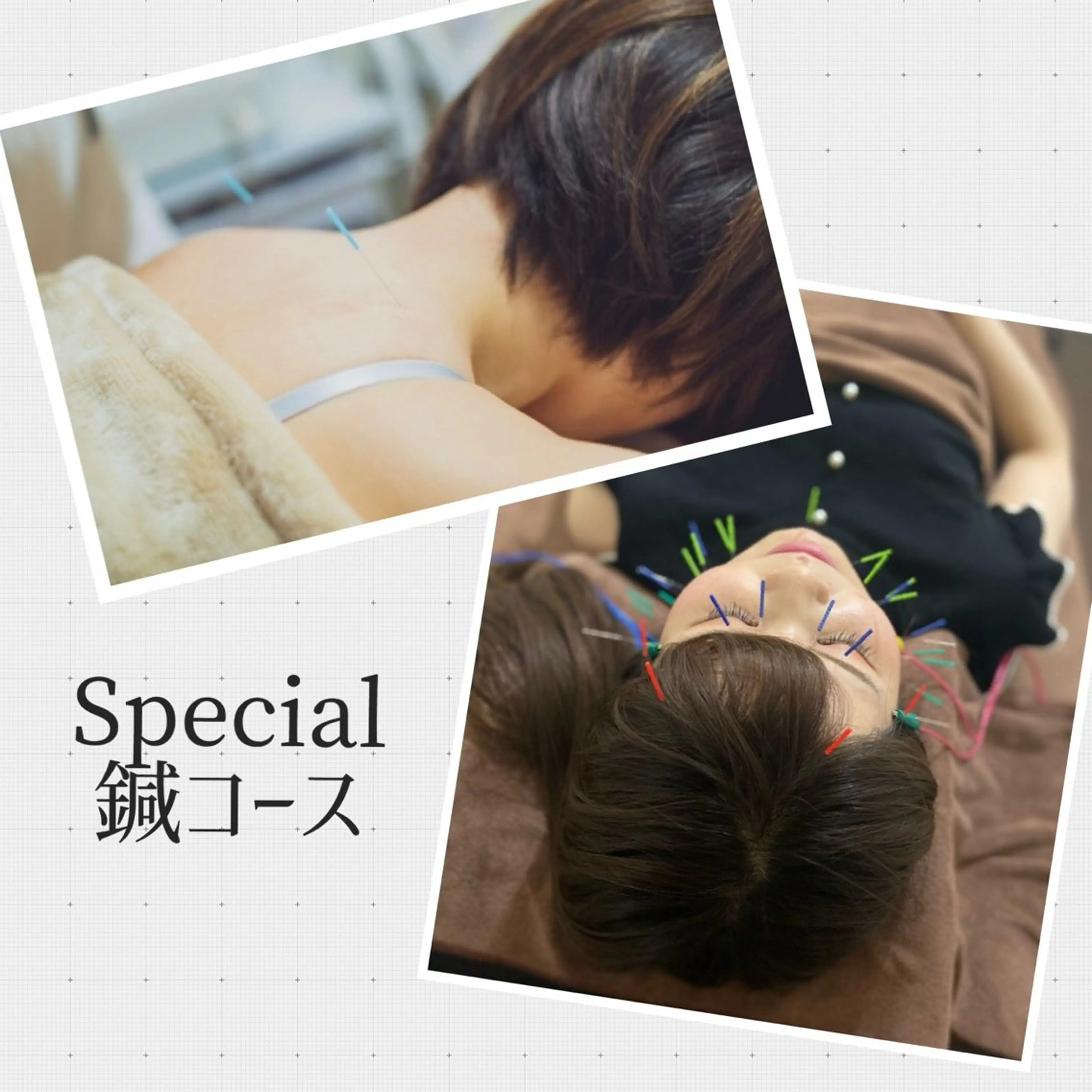 🧚🏻♀️本日限定👗🌟【美容鍼➕身体の鍼】腕鎖骨リンパマッサージ付き🌷の写真