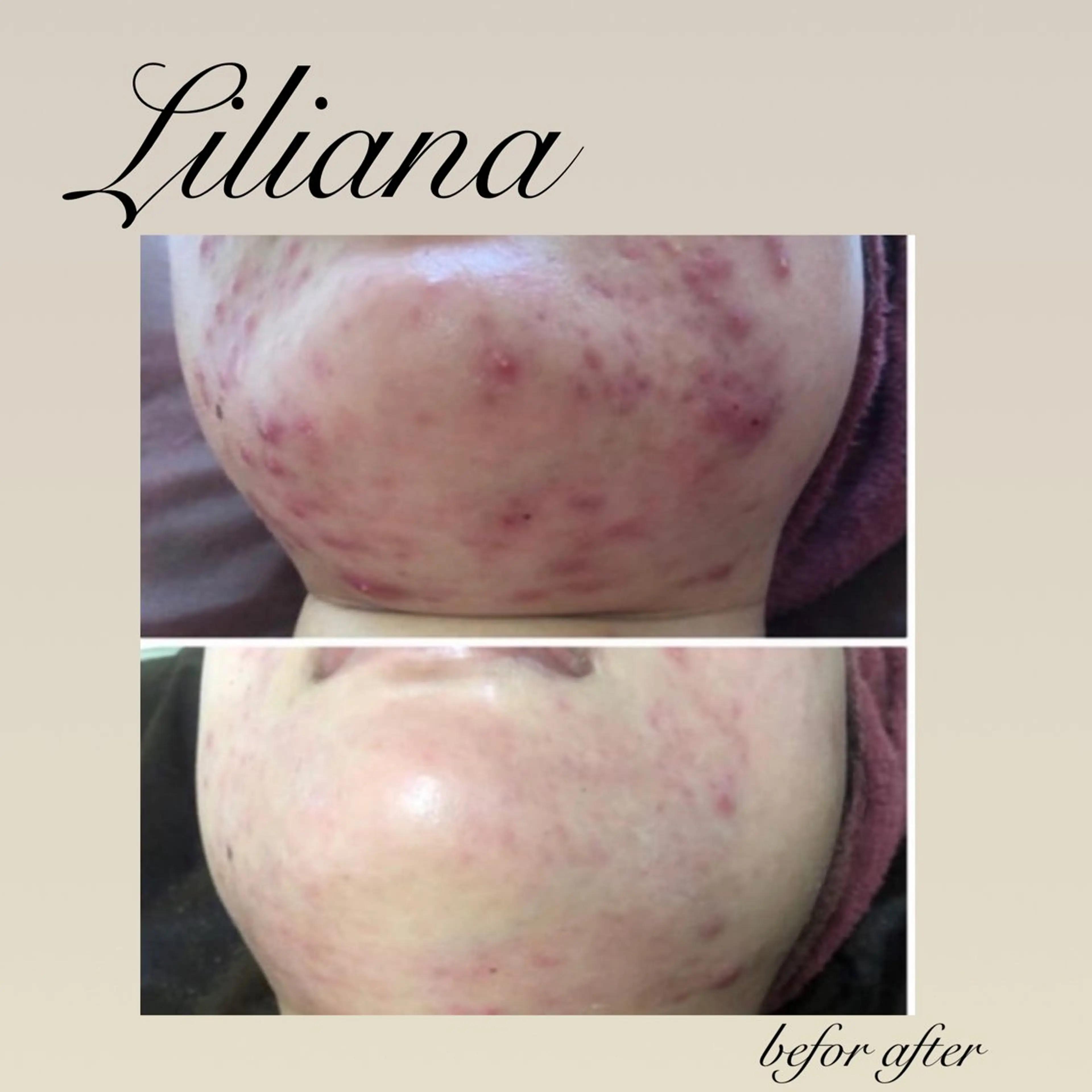 LILIANA所属・LILIANA ☆YURIのエステ・リラクイメージ