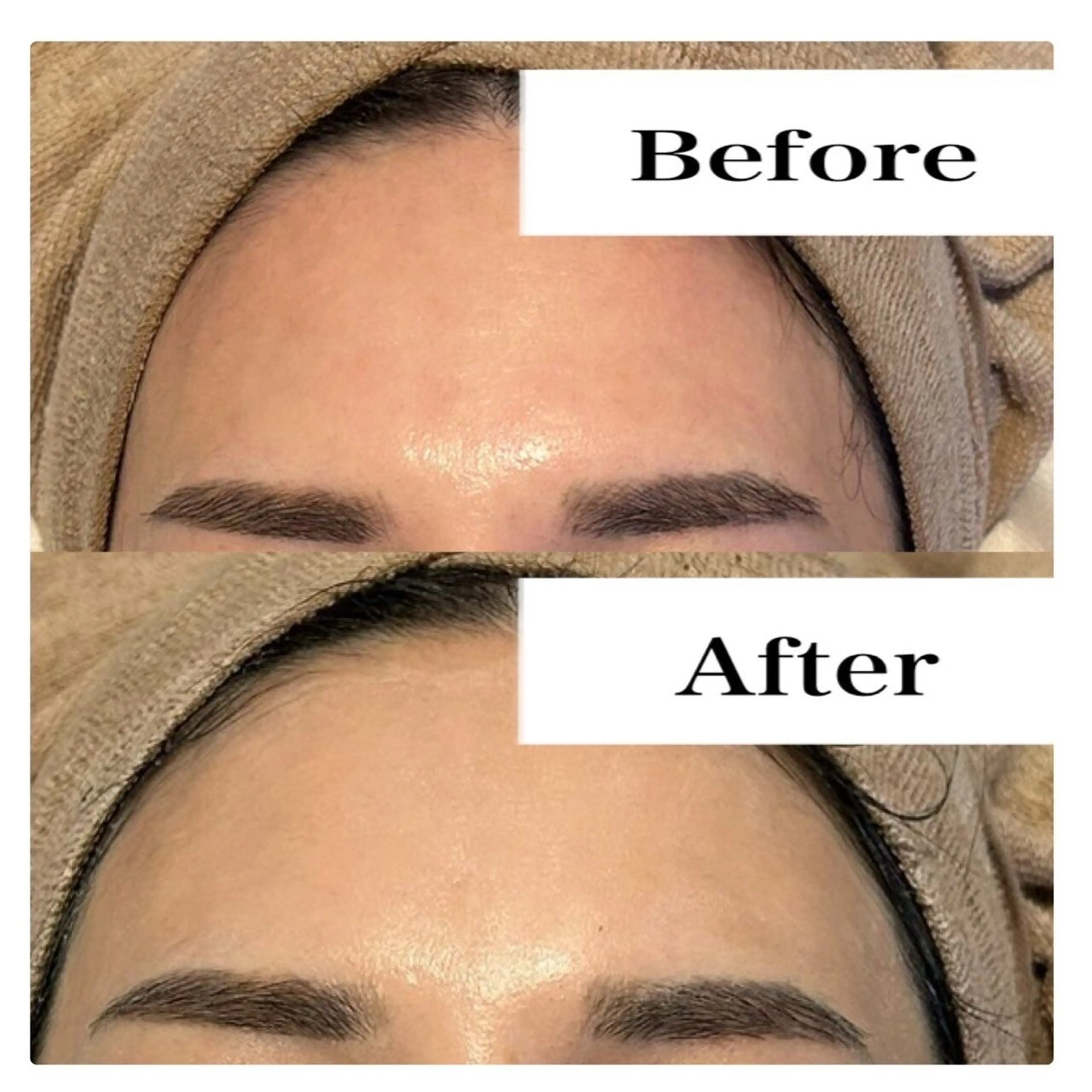 ハーブピーリング LIME池袋東口のエステ・リラクイメージ