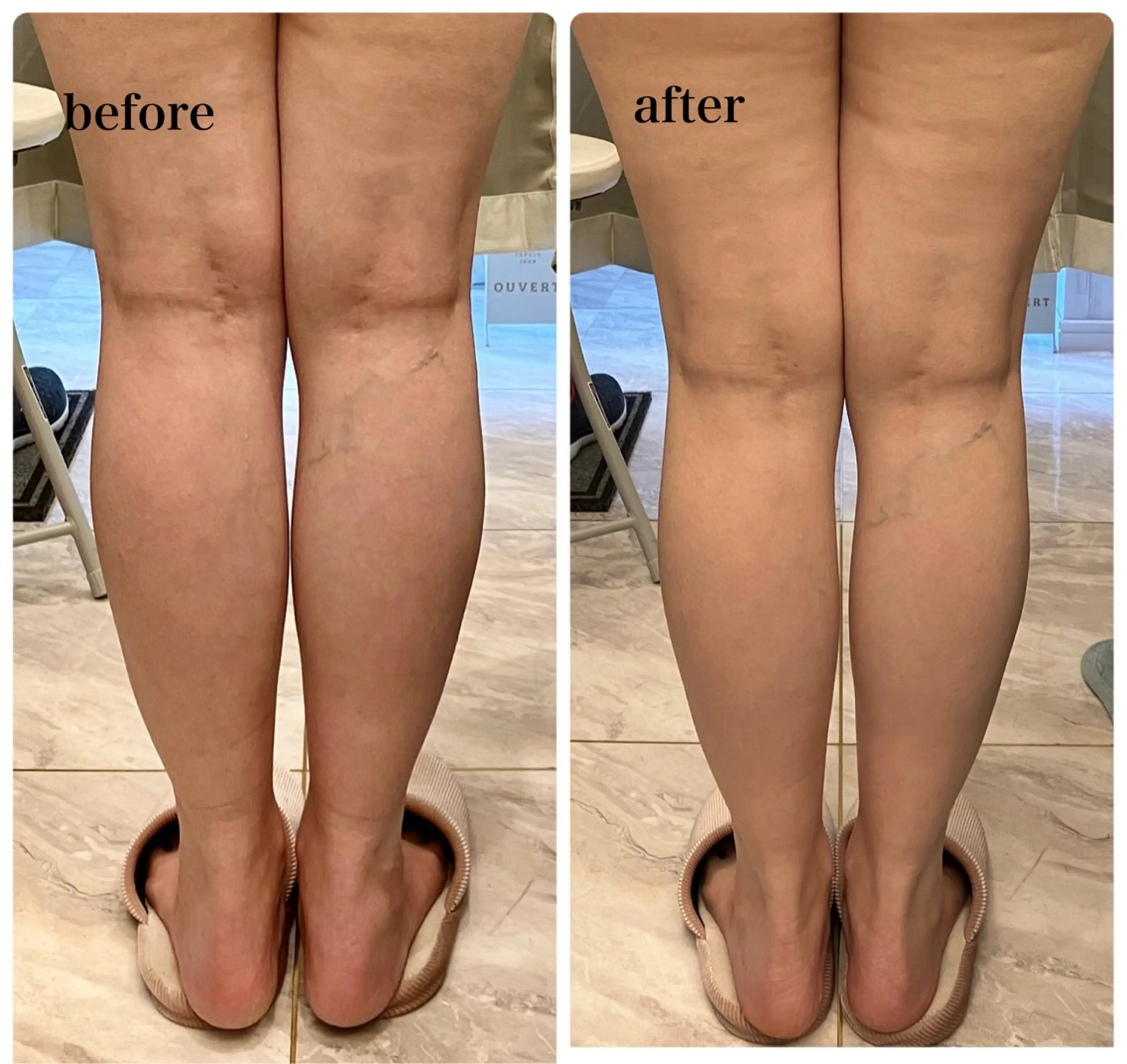 その他 infinity所属・Infinity インフィニティのエステ・リラクイメージ