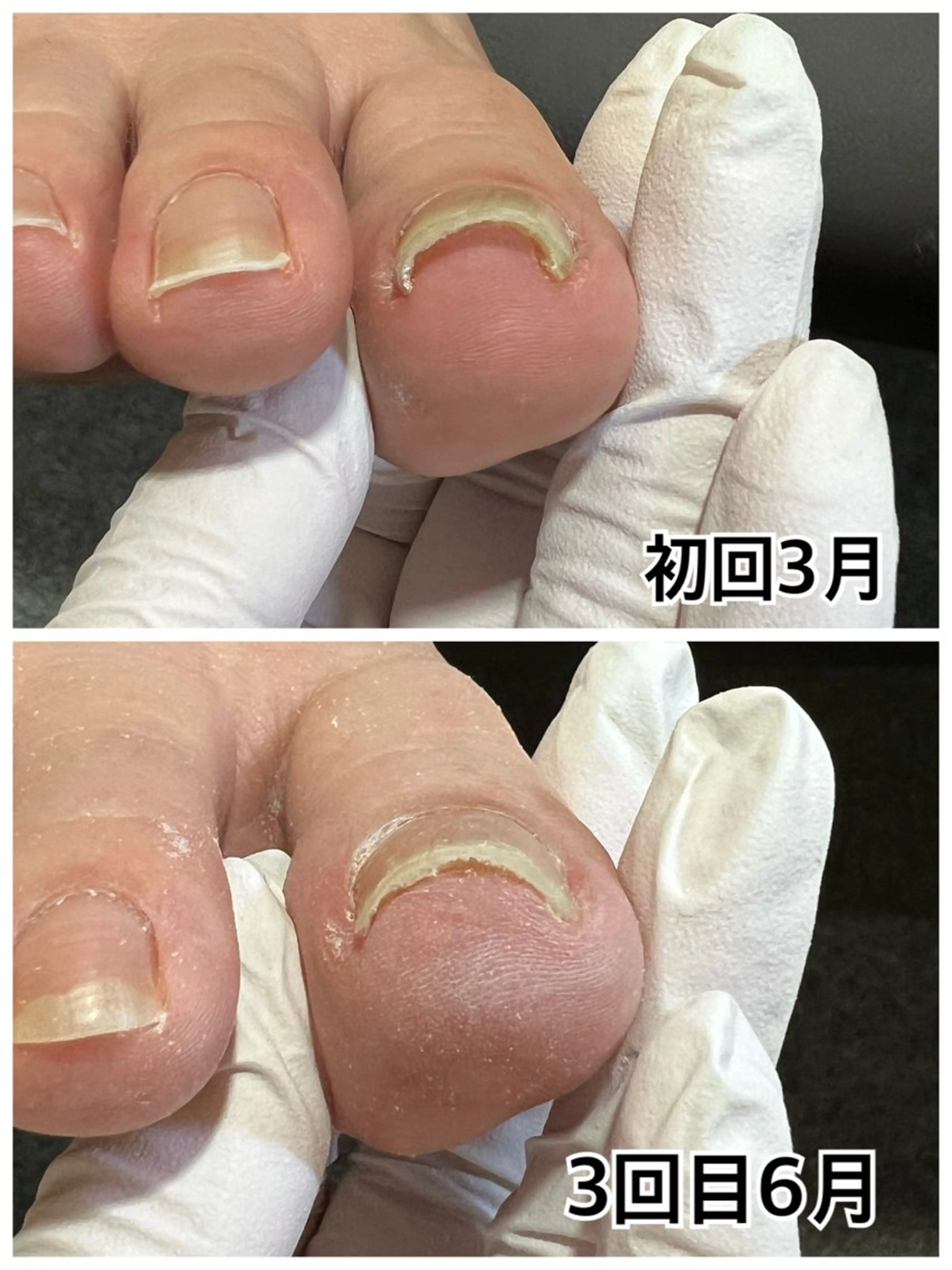 ネイル フットネイル 巻き爪補正店 堺東店のネイルデザイン