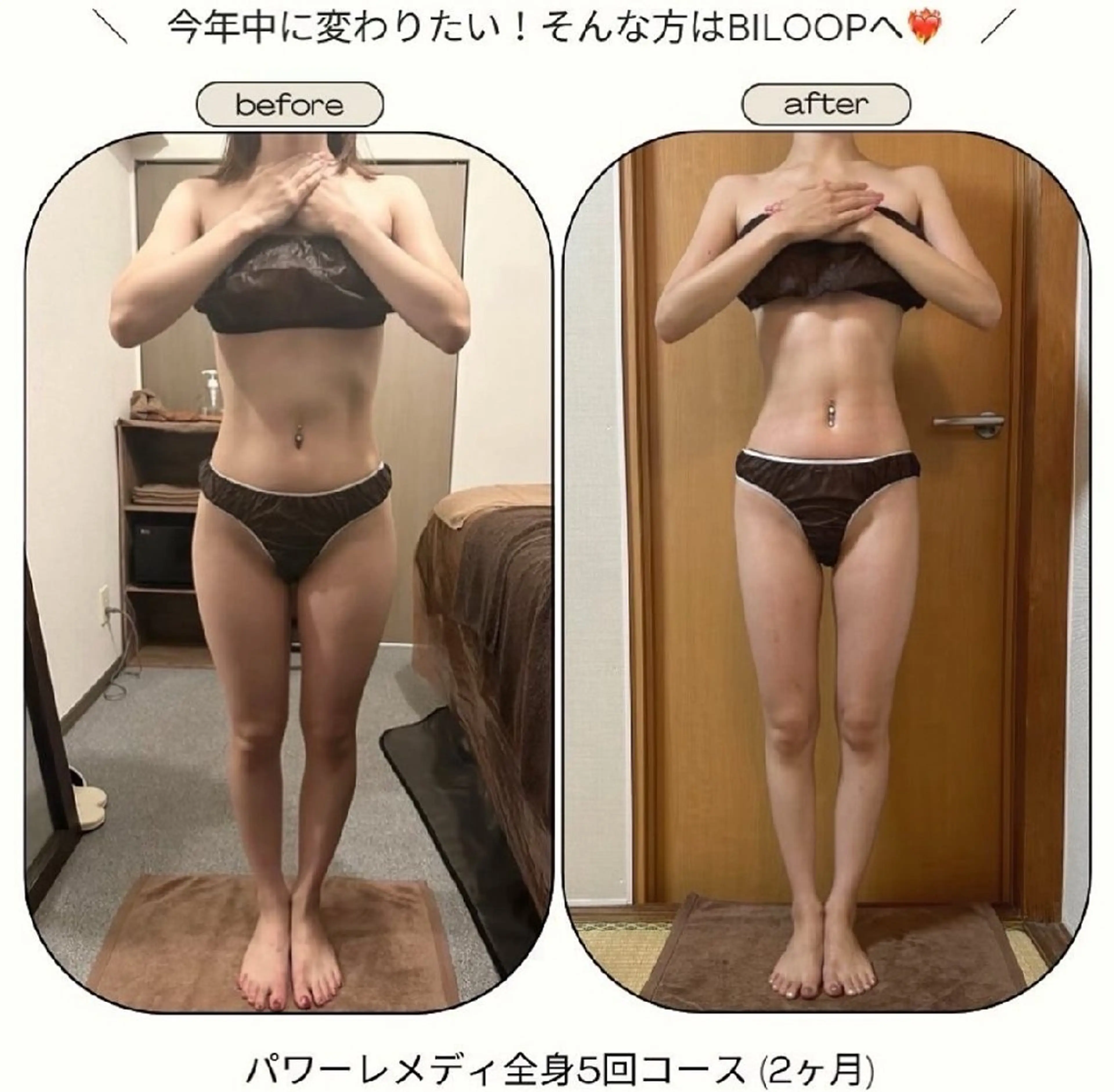 エステ リラク biloop所属・《痩身×疲労改善》 BILOOPのエステ・リラクイメージ