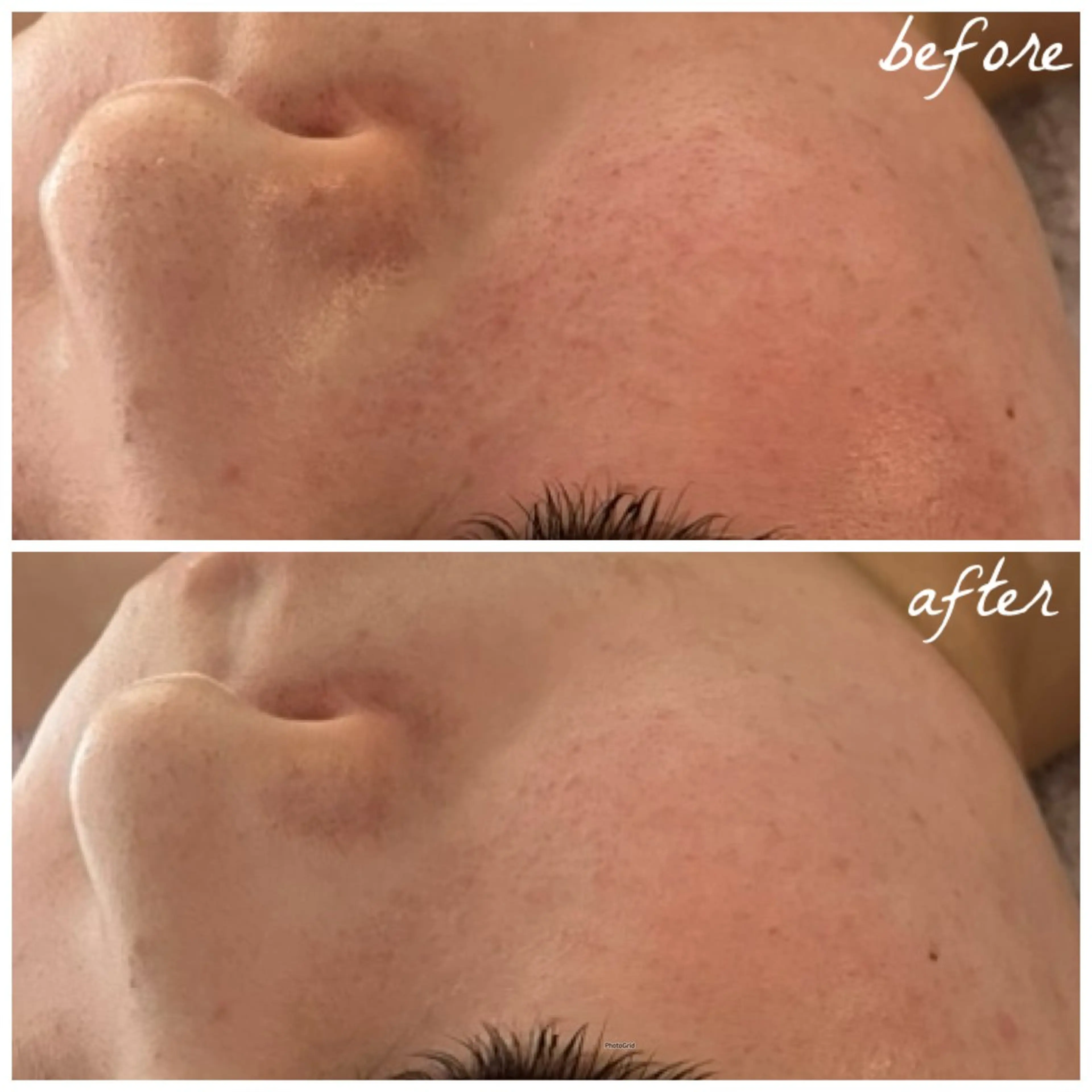 メンズ エステ メナード岐阜茜部 杉浦のエステ・リラクイメージ