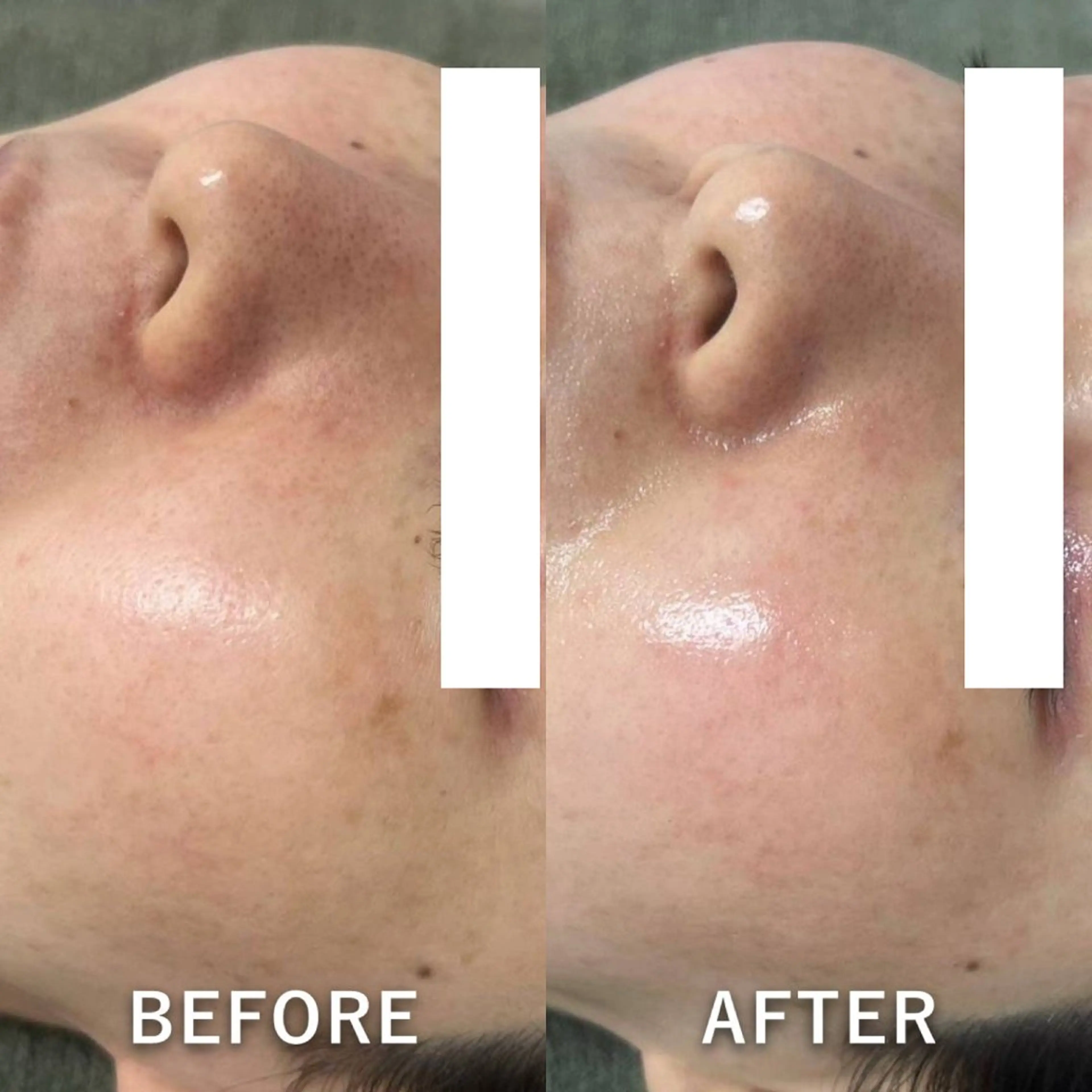 エステ 韓国美肌/肌質改善 【天神】yuiのエステ・リラクイメージ