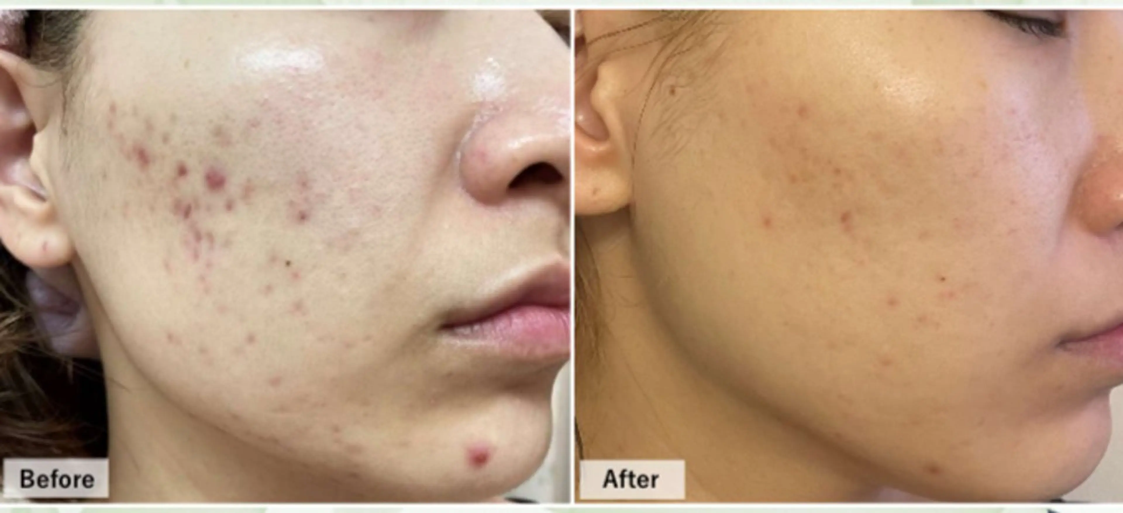 エステ リラク salon aretéのその他イメージ