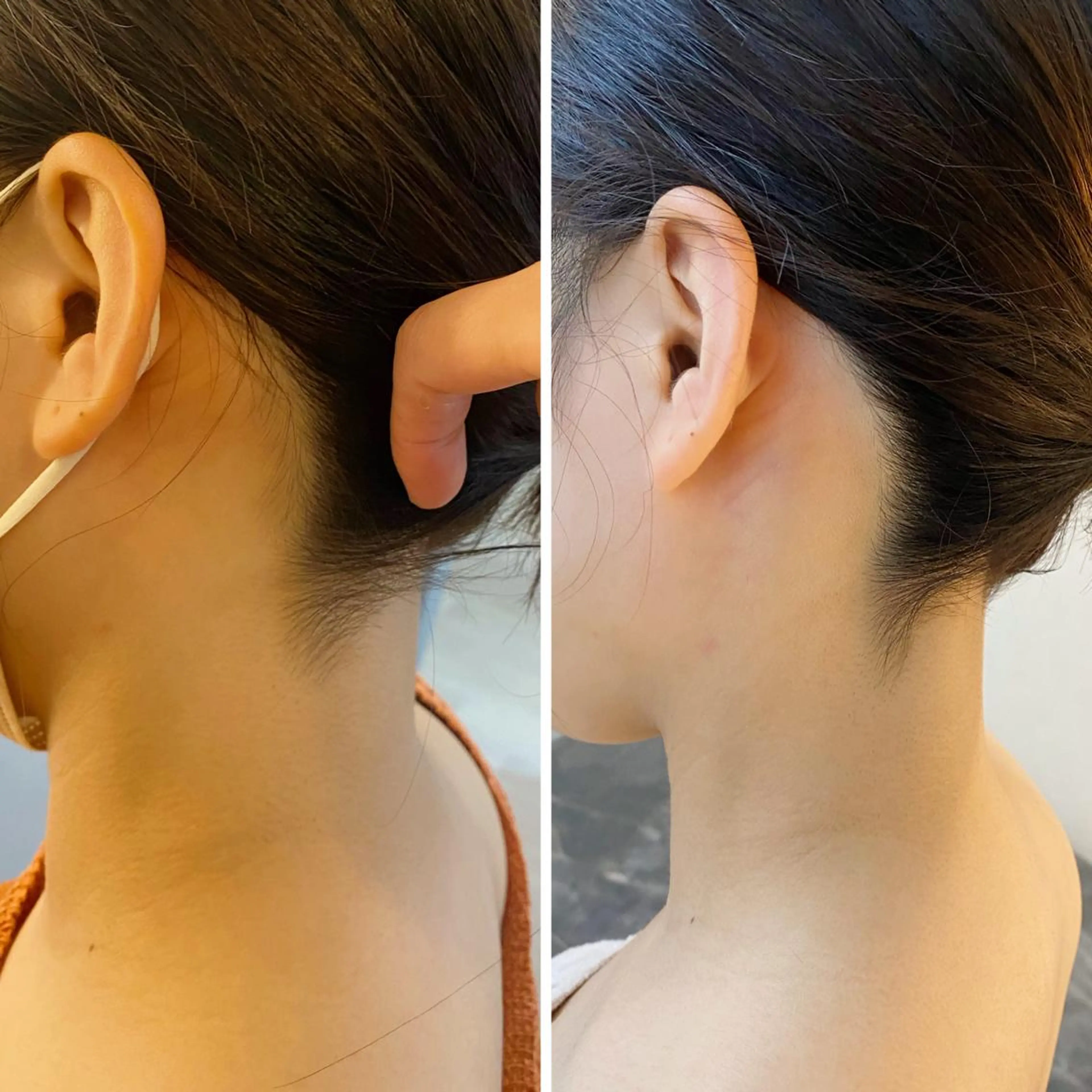 うなじ脱毛/美肌脱毛 LABELのエステ・リラクイメージ