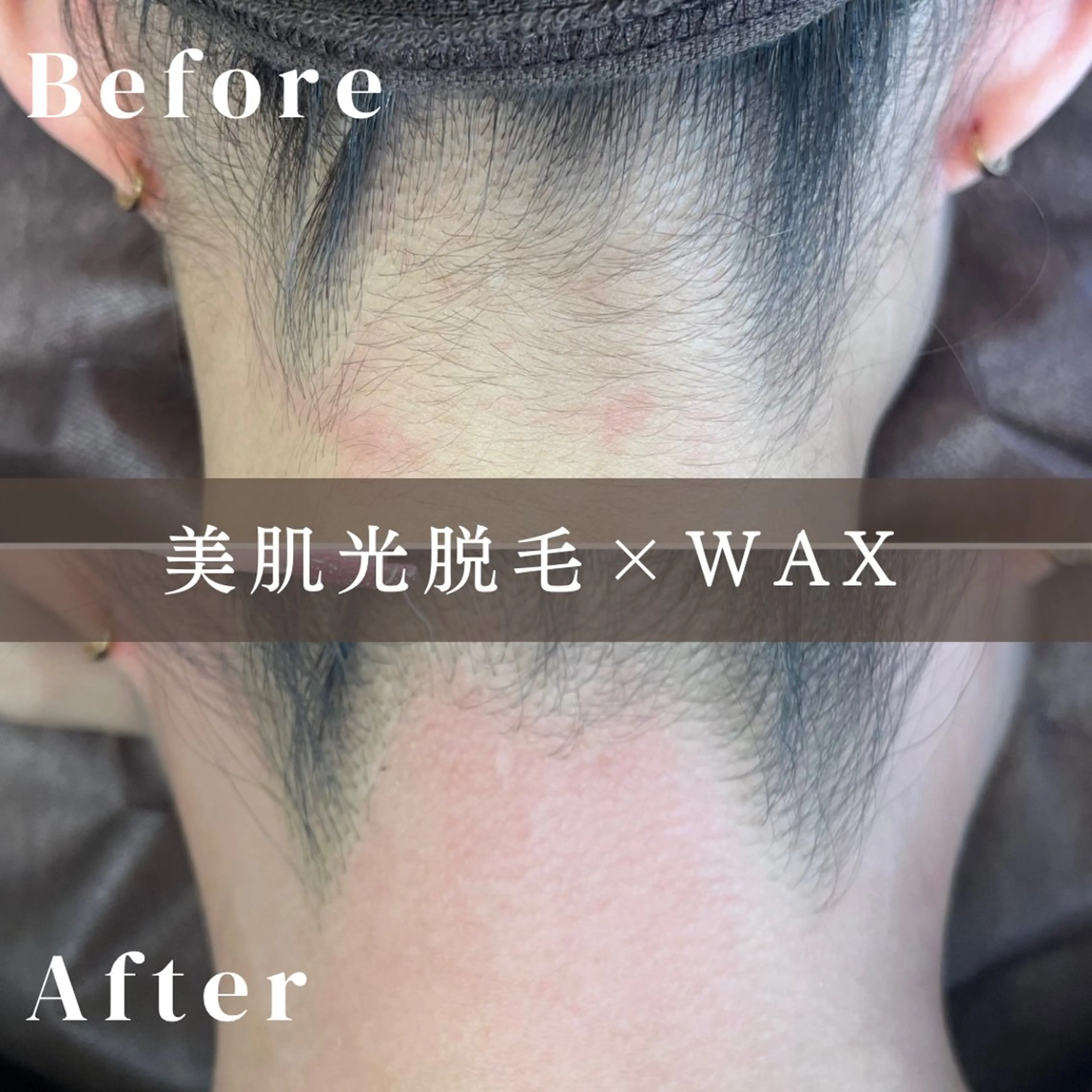 脱毛 《脱毛/韓国肌管理サロン》Epina -エピナ- 横浜店所属・脱毛/韓国肌管理 Epina 横浜店のその他イメージ