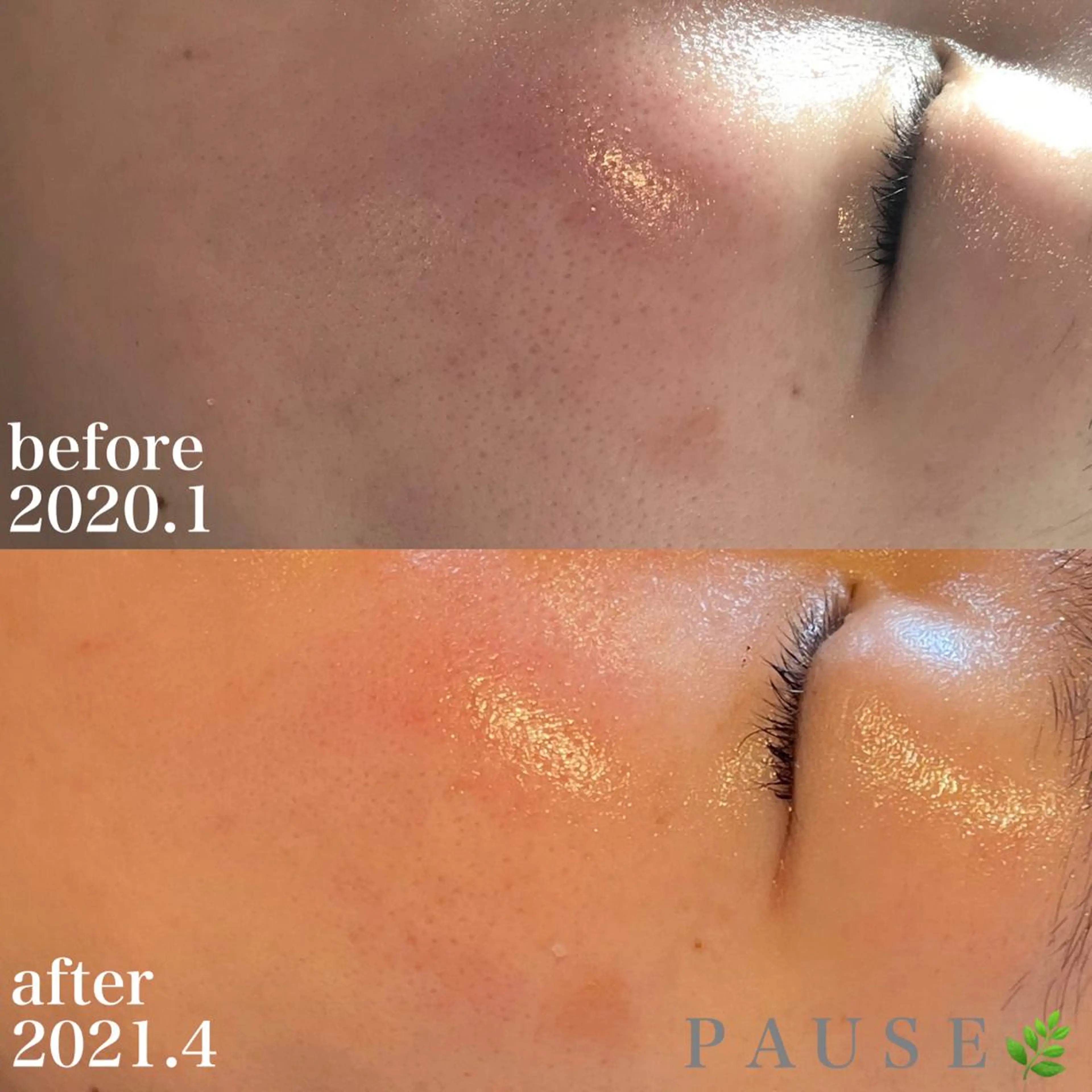 エステ 浜野 恵美のエステ・リラクイメージ