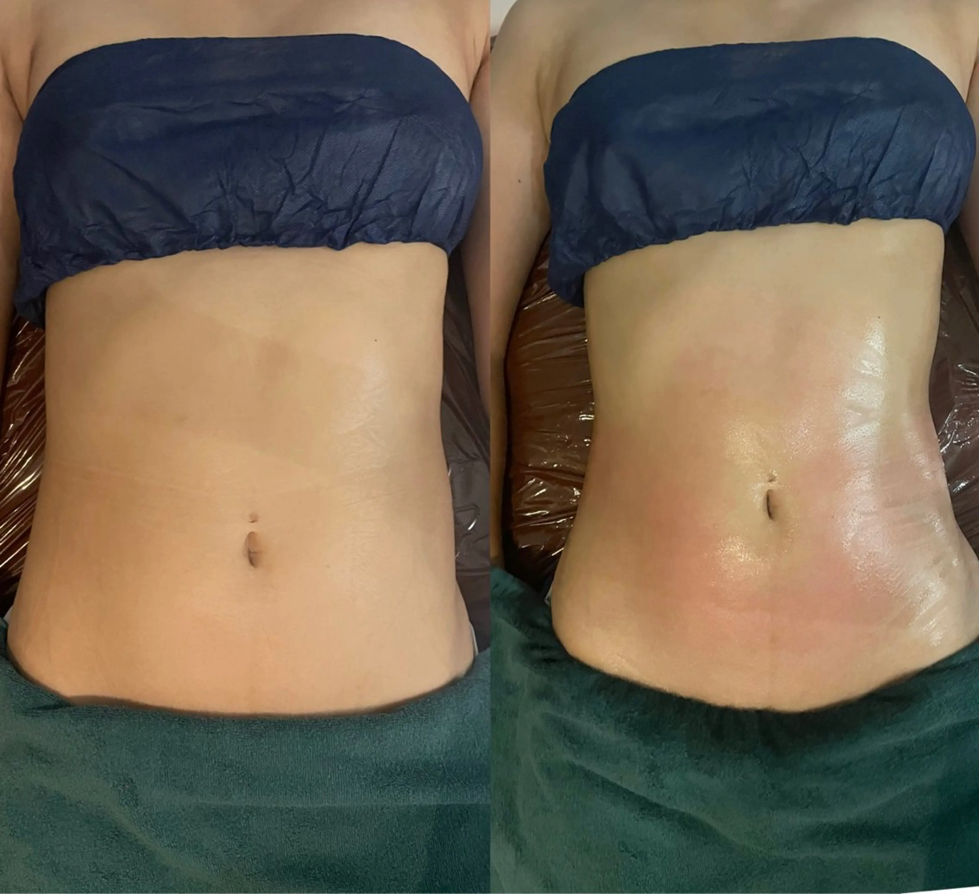 骨気&Relaxation vivian所属・VIVIAN 前田のエステ・リラクイメージ