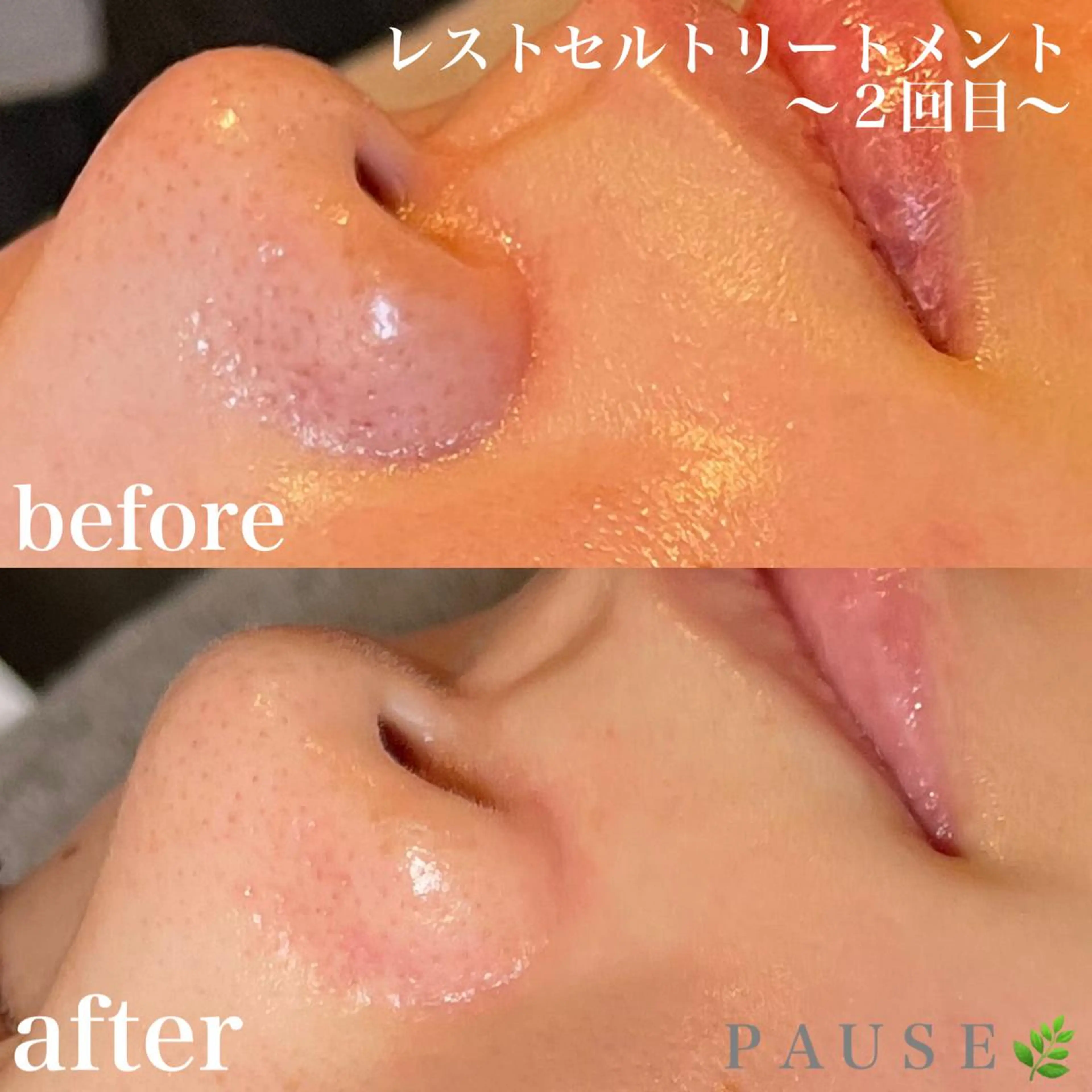 エステ リラク 浜野 恵美のエステ・リラクイメージ