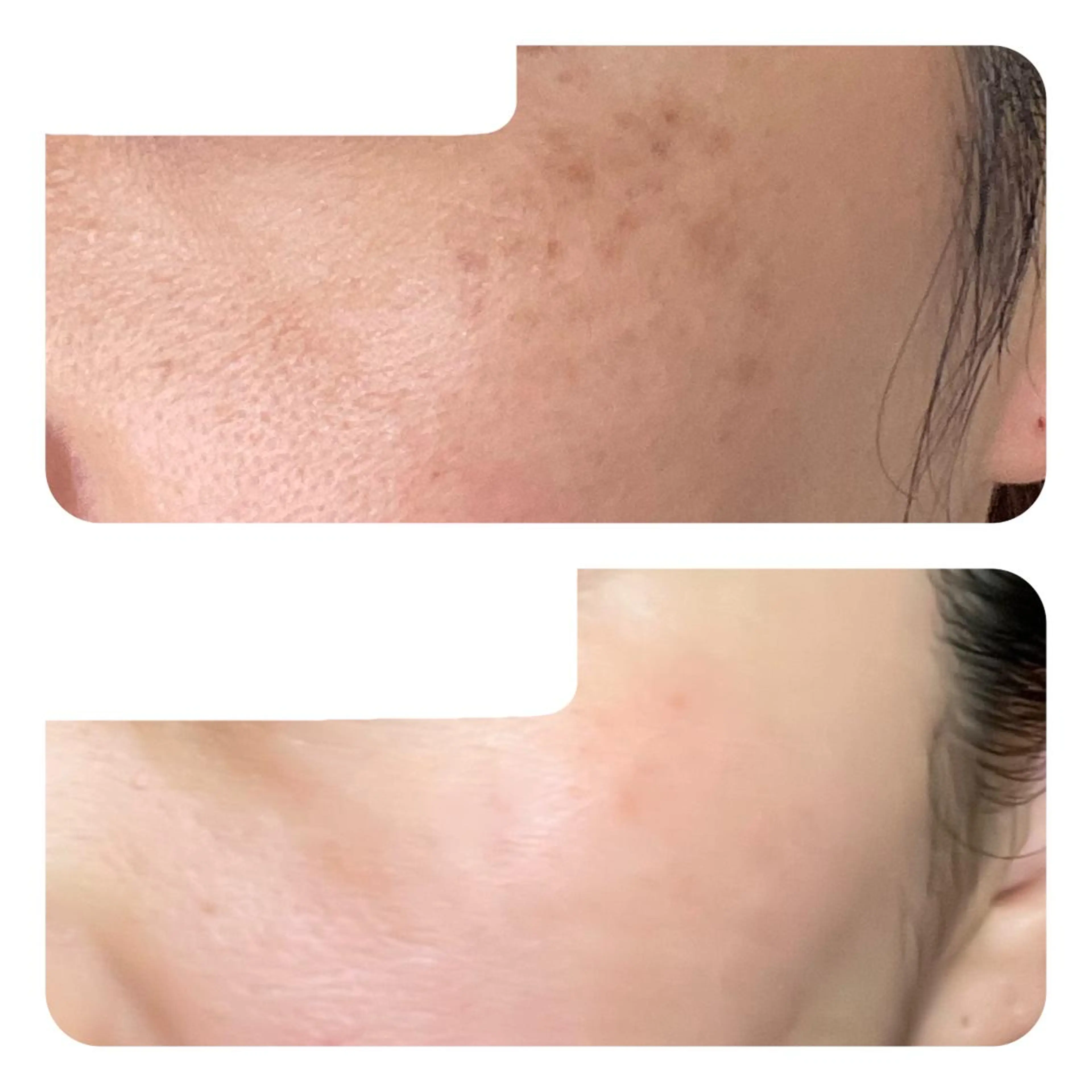 エステ TIERRA(ティエラ)所属・TIERRA ♡のエステ・リラクイメージ