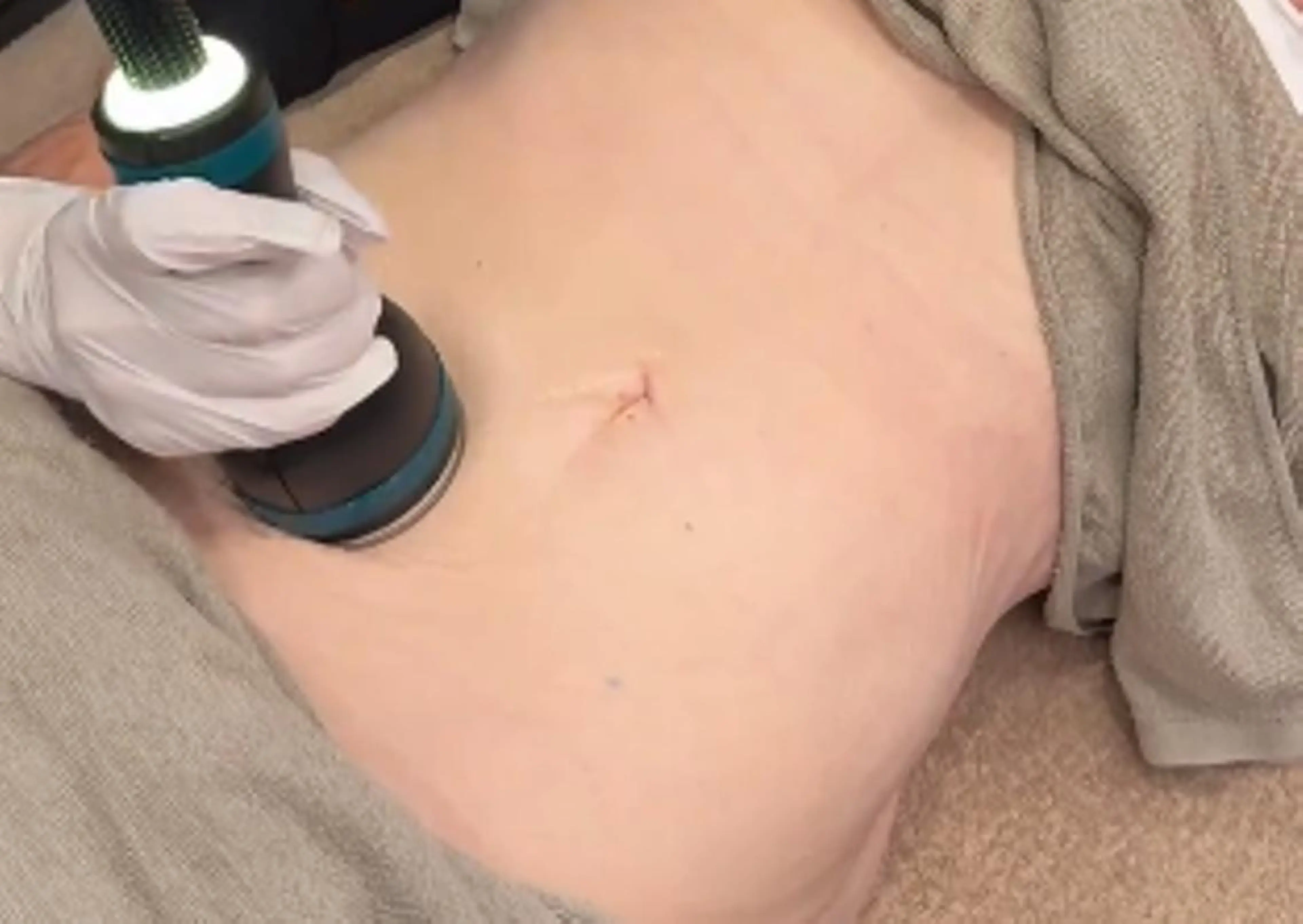 エステ 顔脱毛＆毛穴＆ニキビ 優良№1♪ヒロコ♪のエステ・リラクイメージ