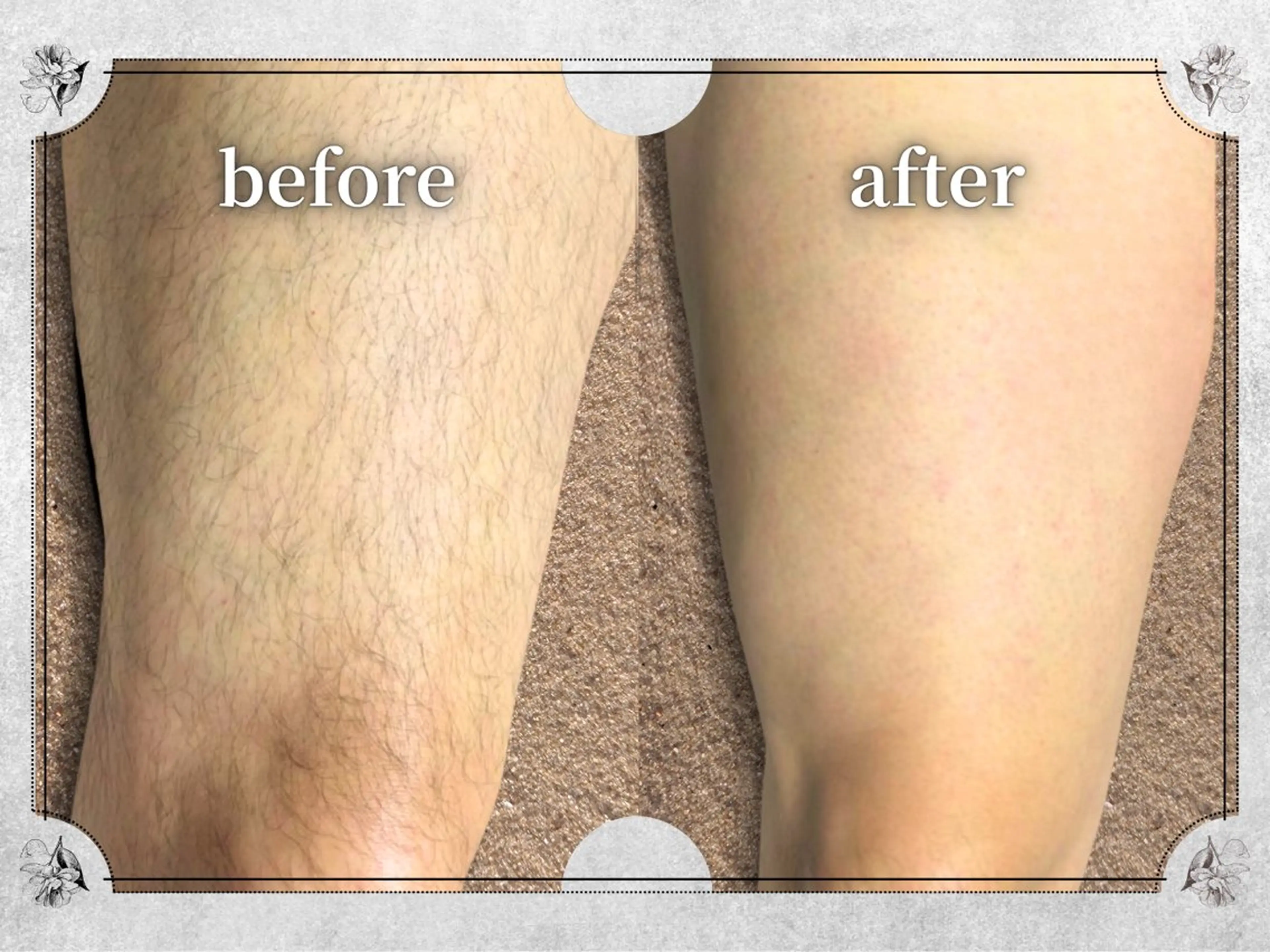 都度払い脱毛 Lino柏/Moneのエステ・リラクイメージ