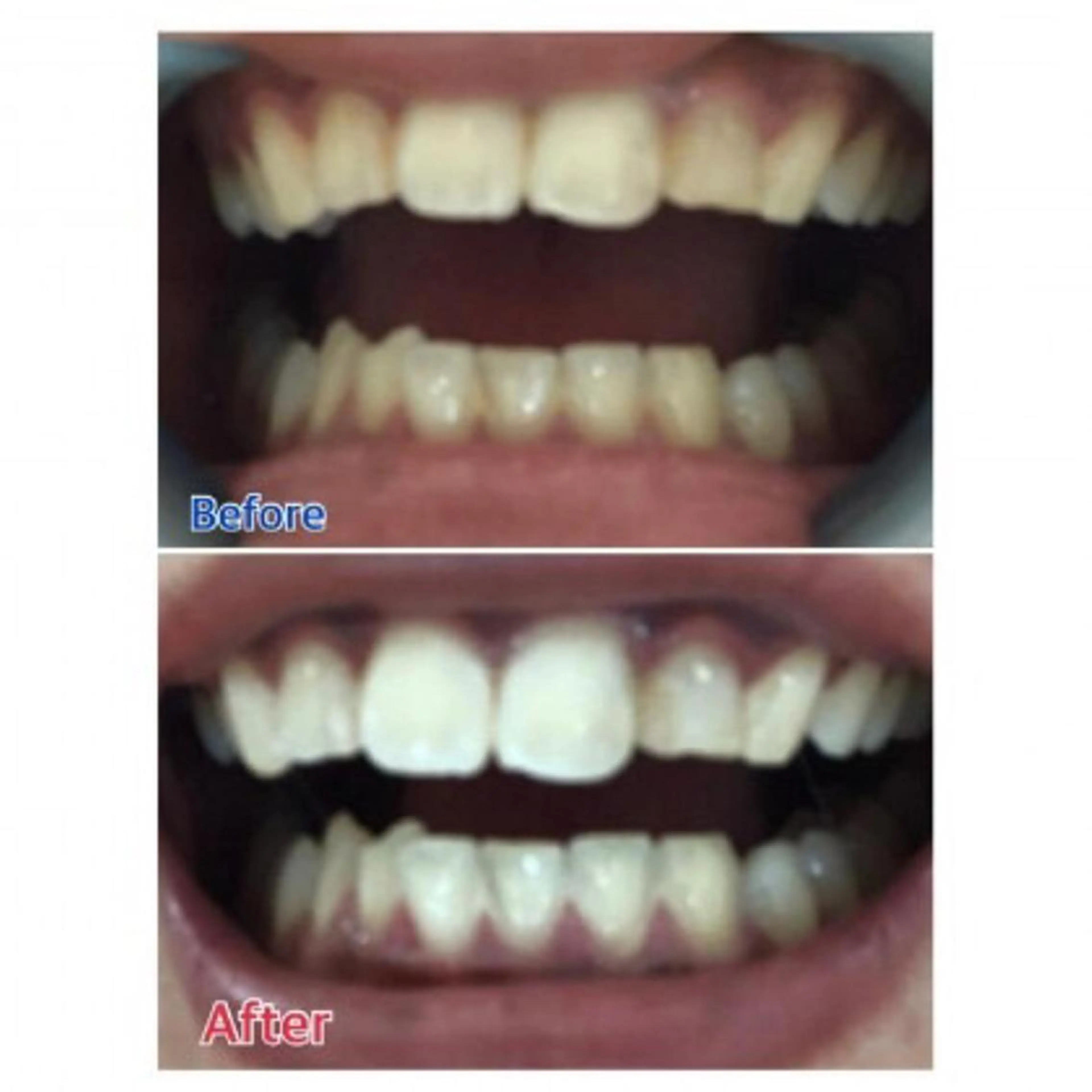 M渋谷店所属・Ｍ渋谷 ホワイトニングのエステ・リラクイメージ