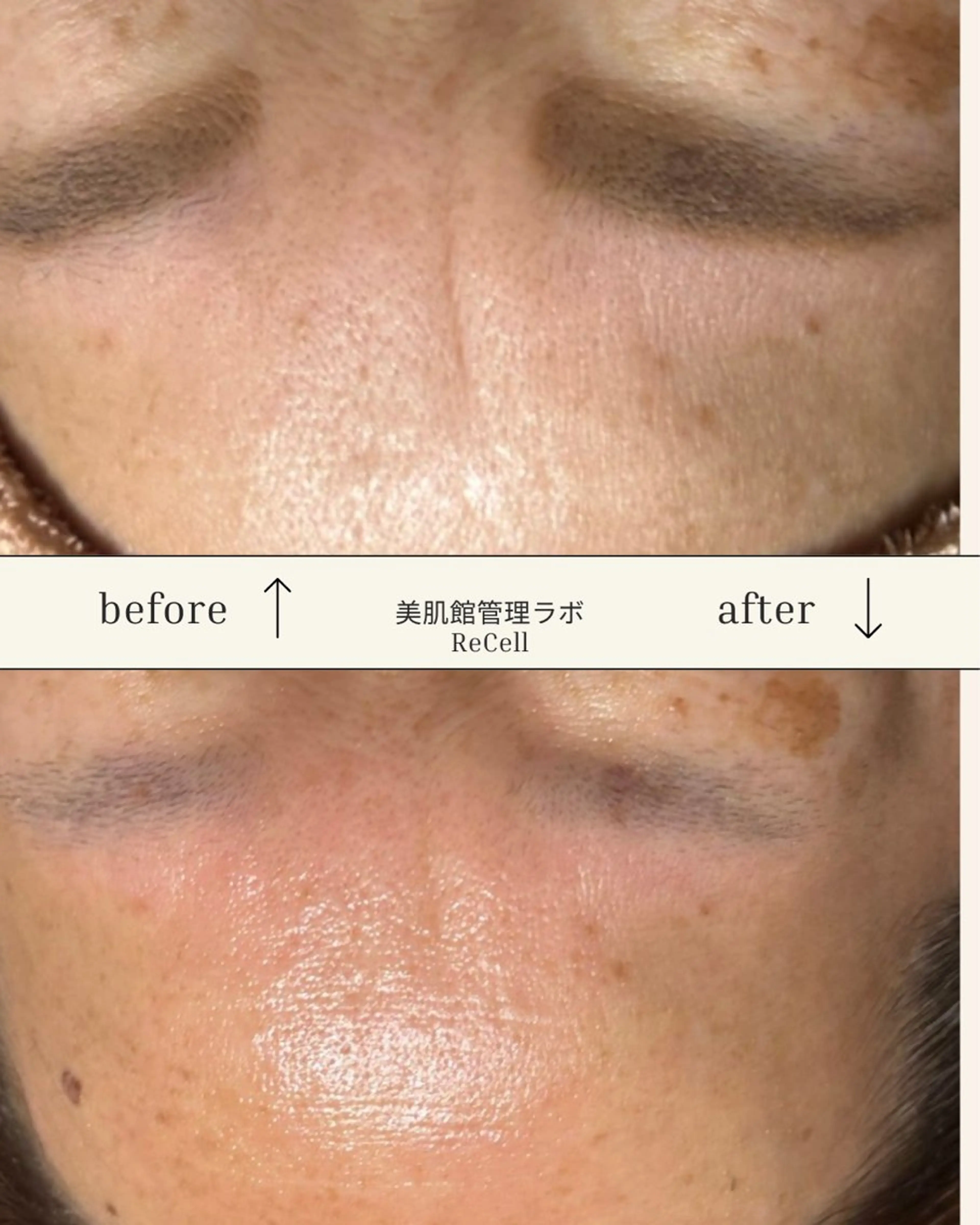 ReCell 肌管理のエステ・リラクイメージ