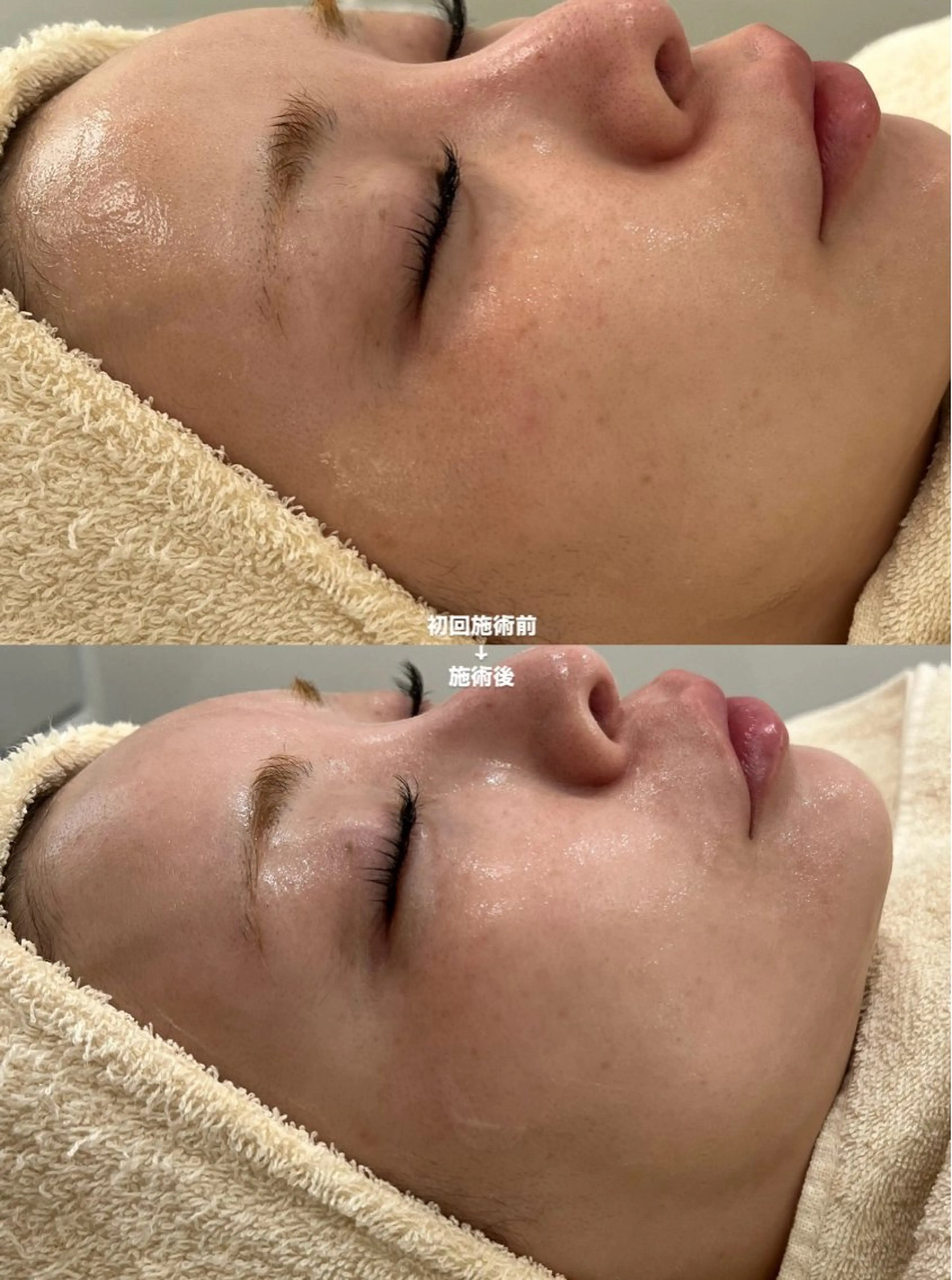 エステサロンTug高知駅前店所属・Tug 高知駅前店/ NANAMI🌐のエステ・リラクイメージ