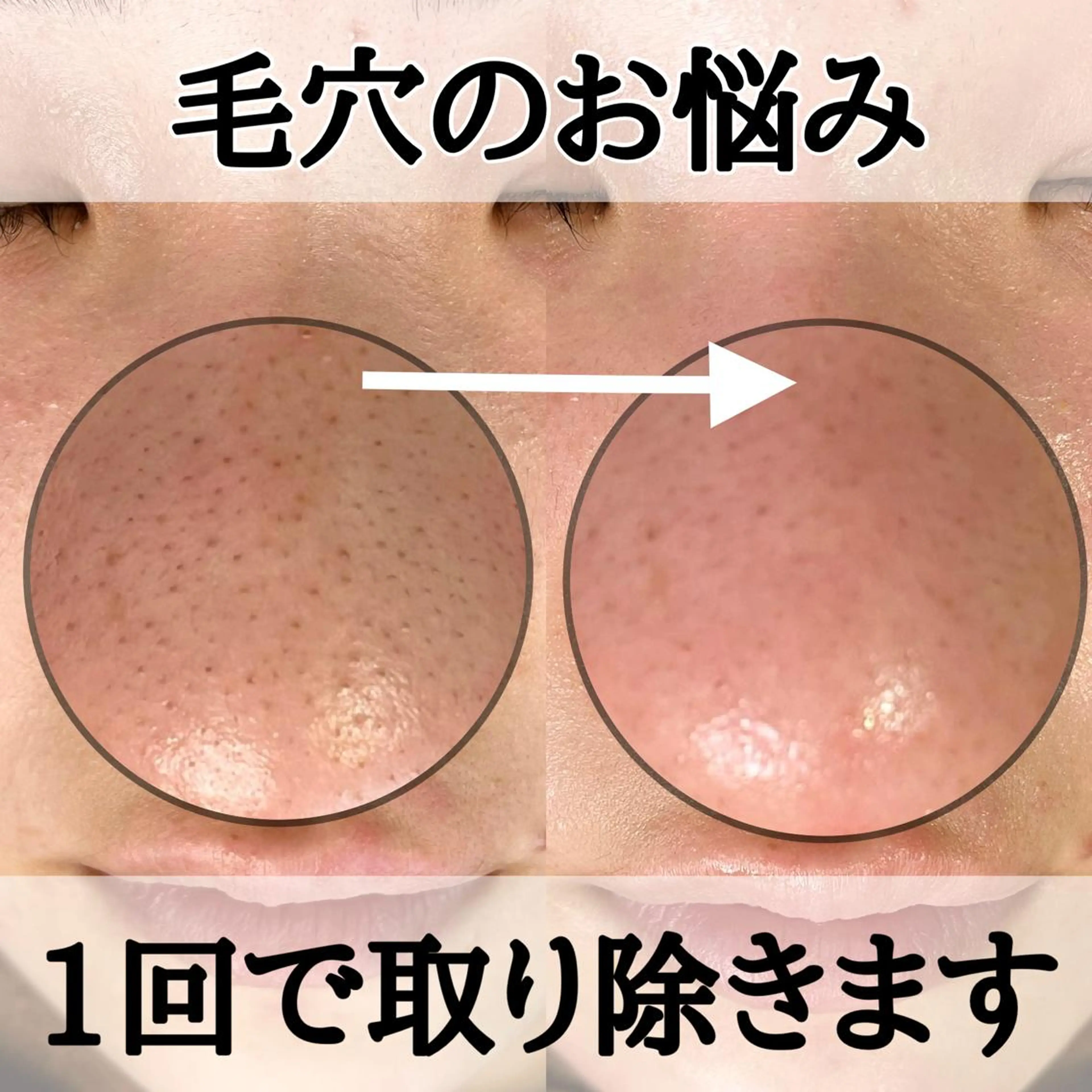 Prism  eye オチアイのマツエク・マツパデザイン