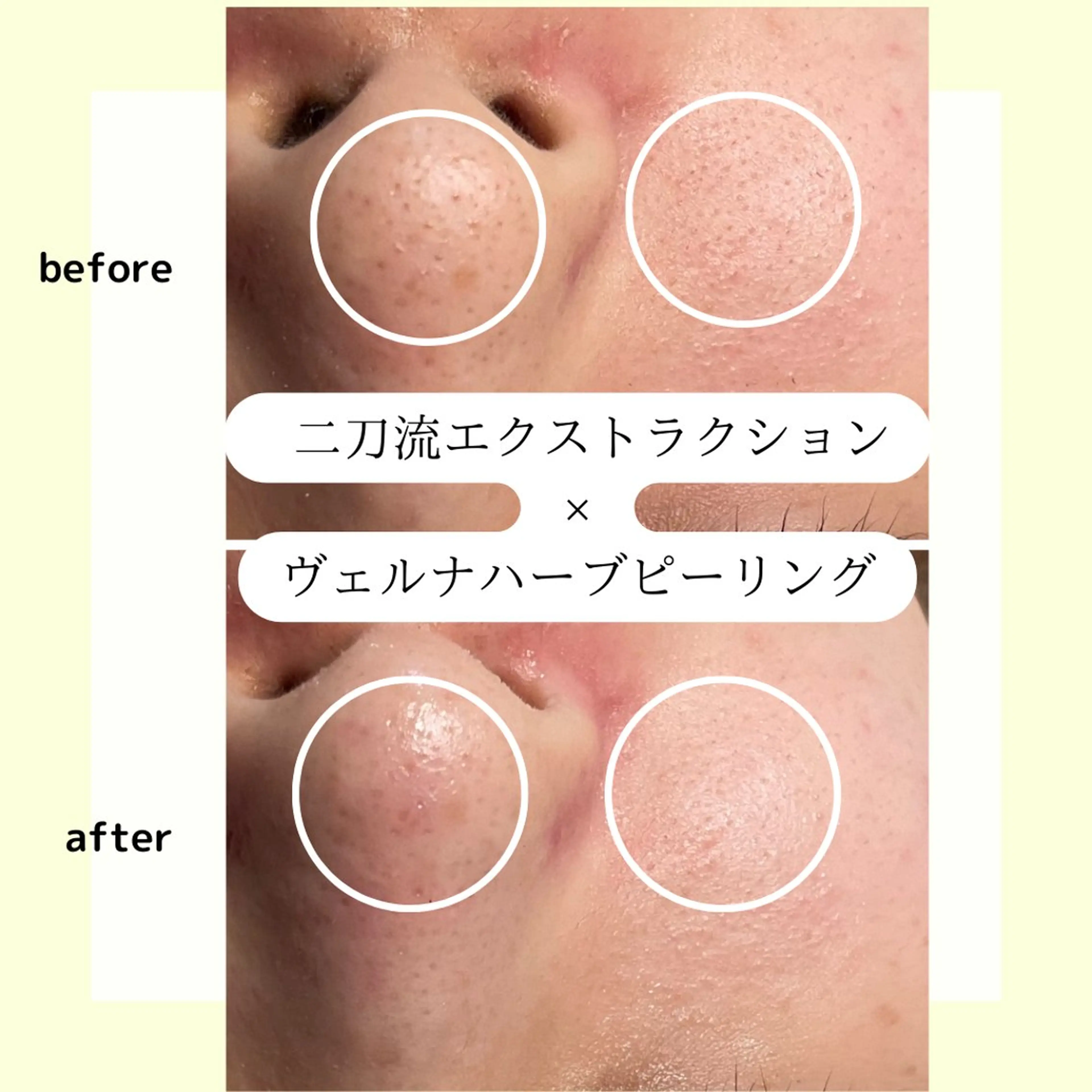 ピーリング専門店 Belluteのエステ・リラクイメージ